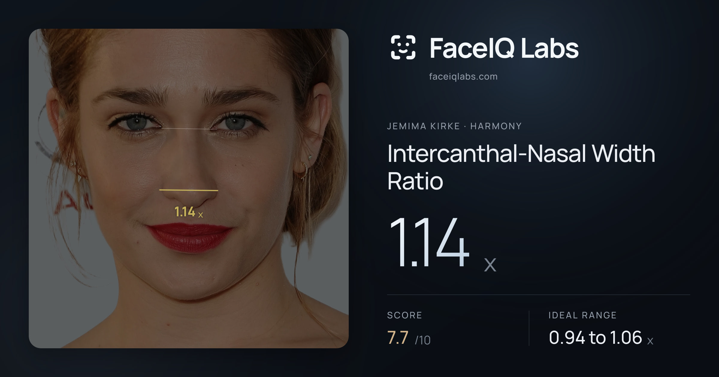 Jemima Kirke Intercanthal-Nasal Width Ratio: 1.14x, drawn on the photo