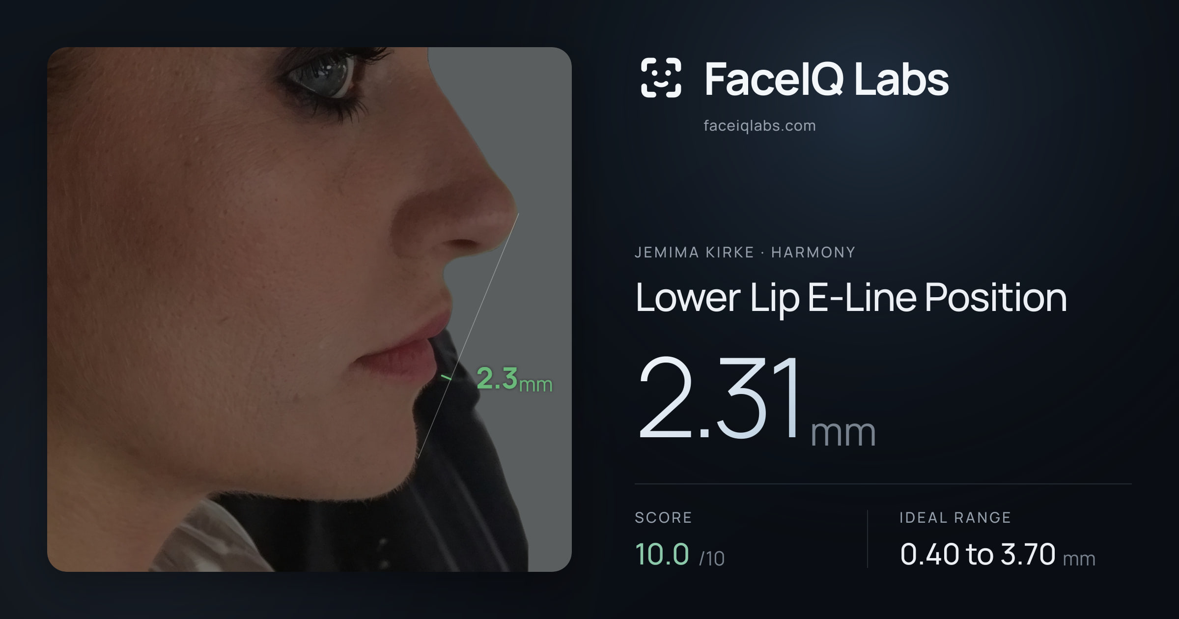 Jemima Kirke Lower Lip E-Line Position: 2.31mm, drawn on the photo