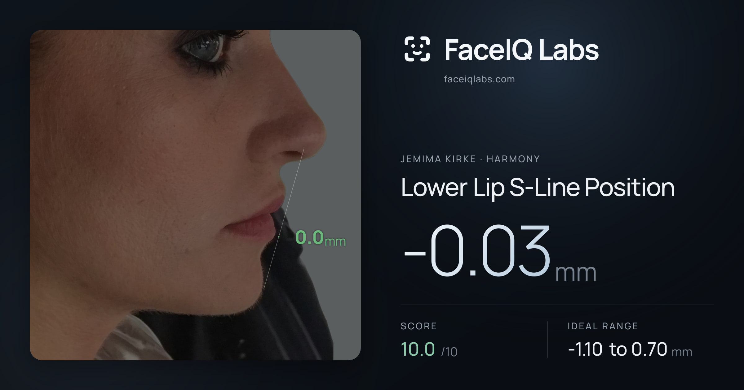 Jemima Kirke Lower Lip S-Line Position: -0.03mm, drawn on the photo