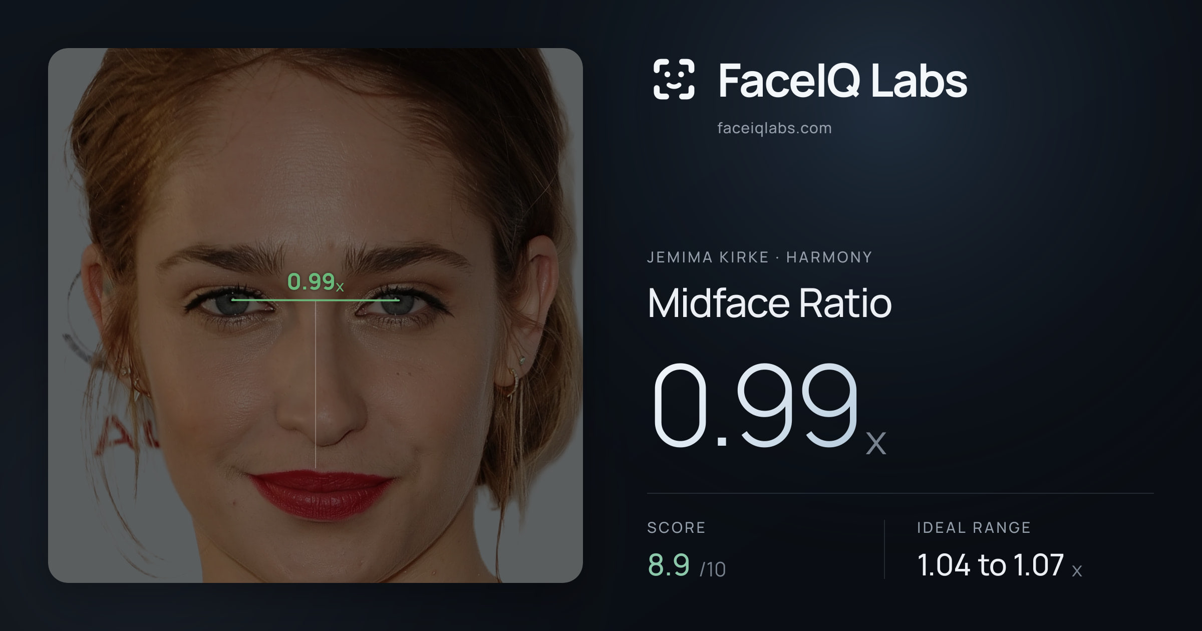 Jemima Kirke Midface Ratio: 0.99x, drawn on the photo