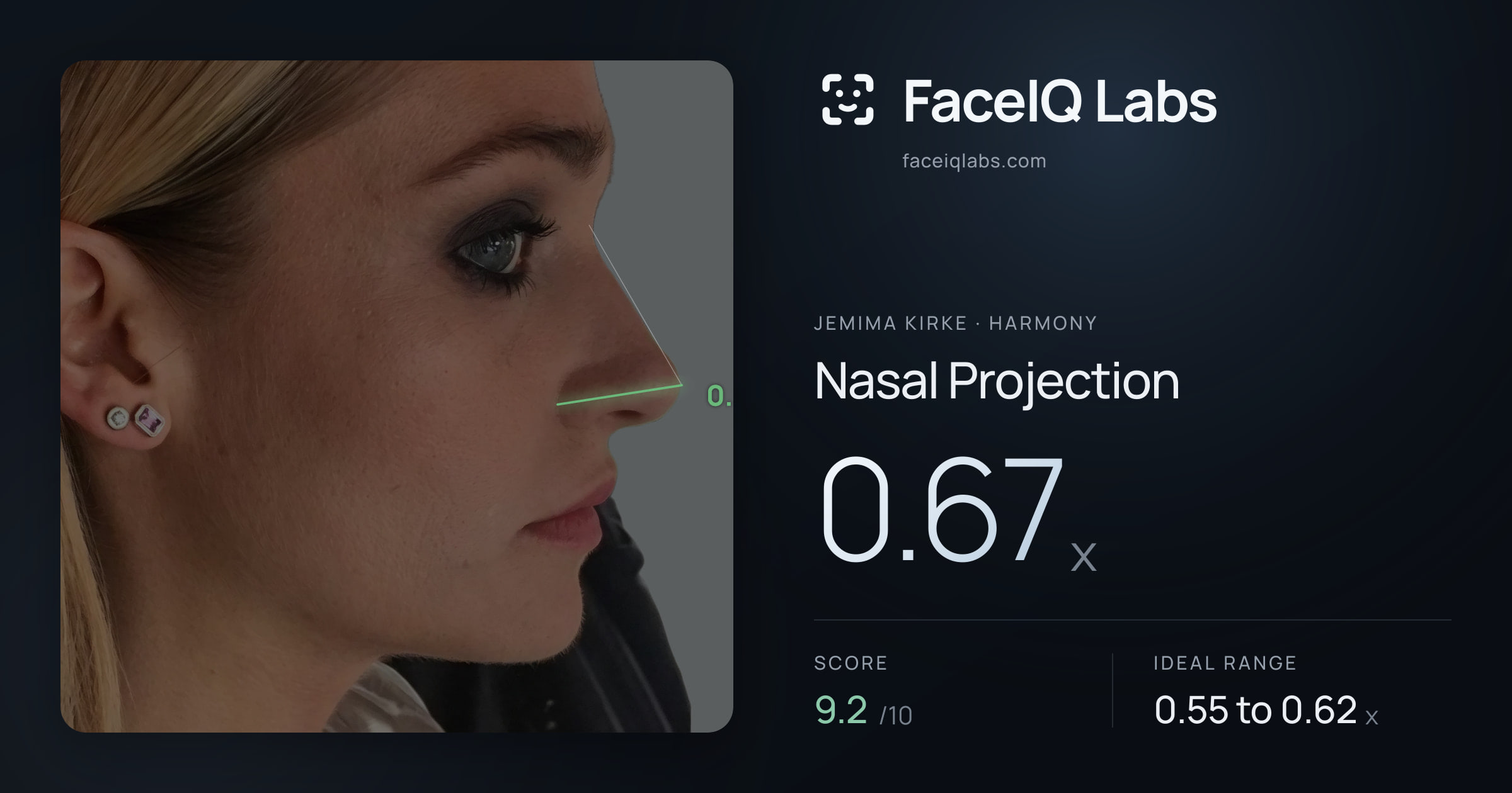 Jemima Kirke Nasal Projection: 0.67x, drawn on the photo
