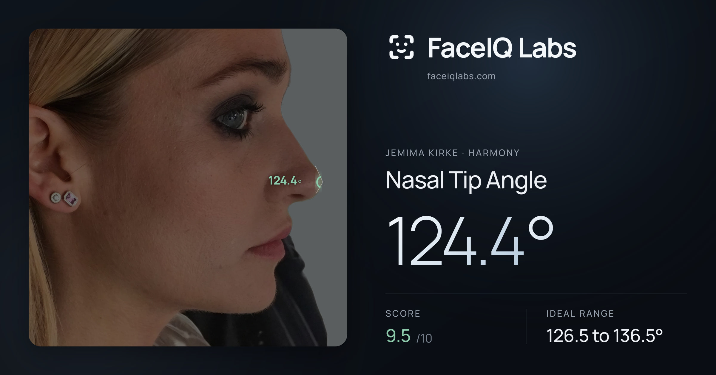 Jemima Kirke Nasal Tip Angle: 124.4°, drawn on the photo