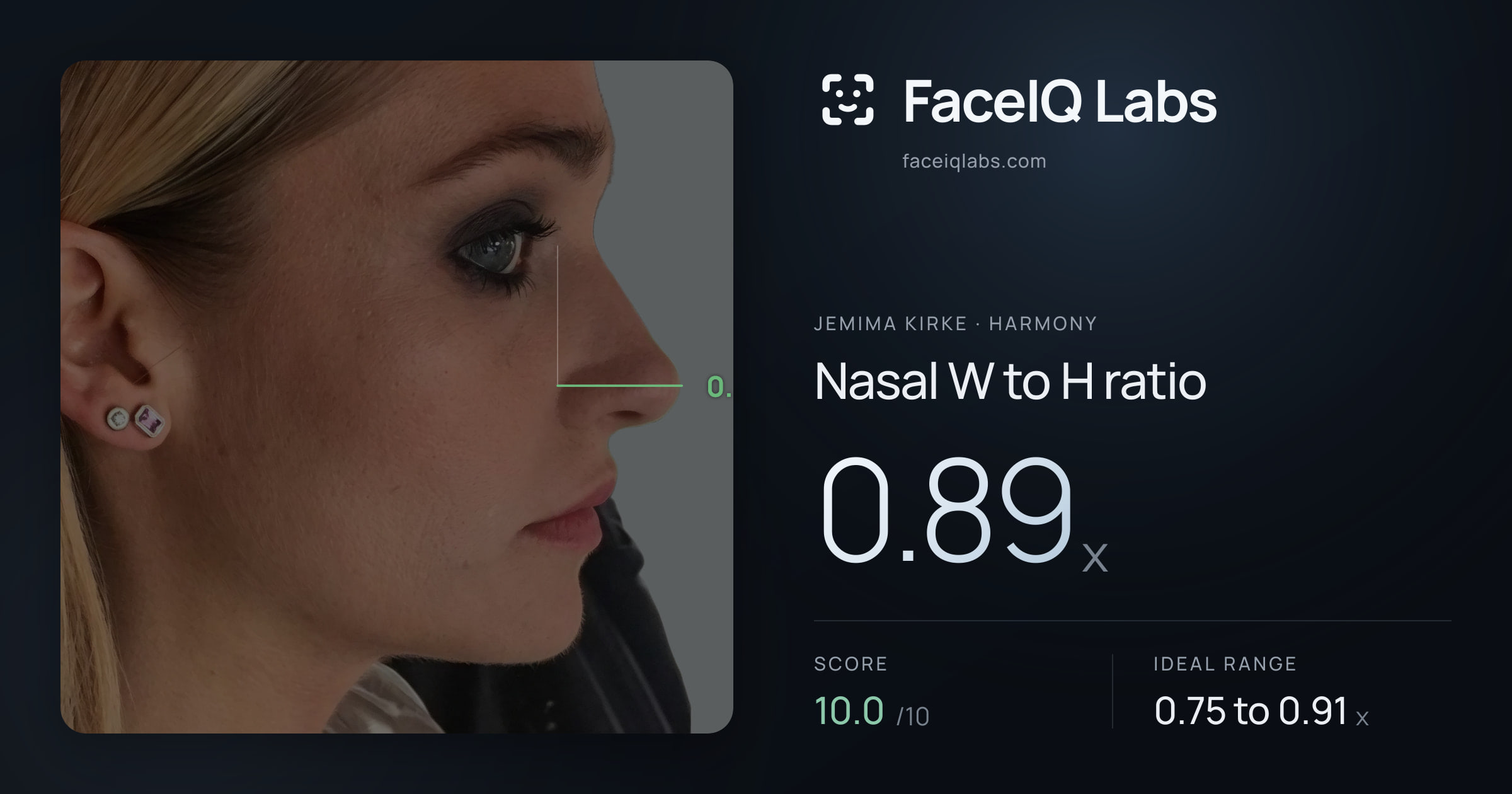 Jemima Kirke Nasal W to H ratio: 0.89x, drawn on the photo