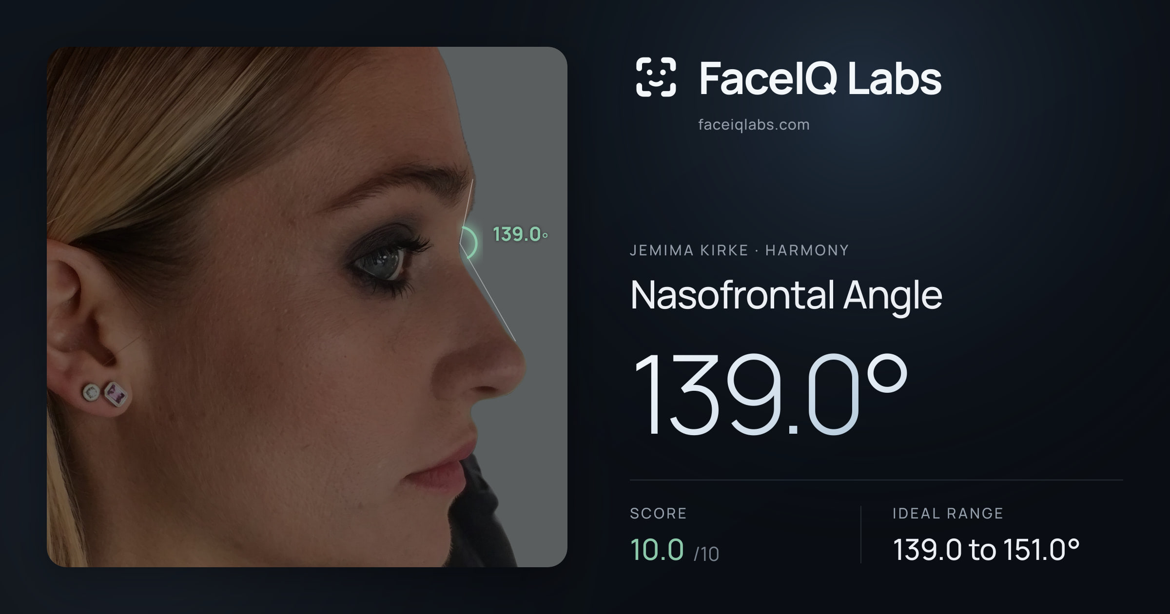 Jemima Kirke Nasofrontal Angle: 139.0°, drawn on the photo