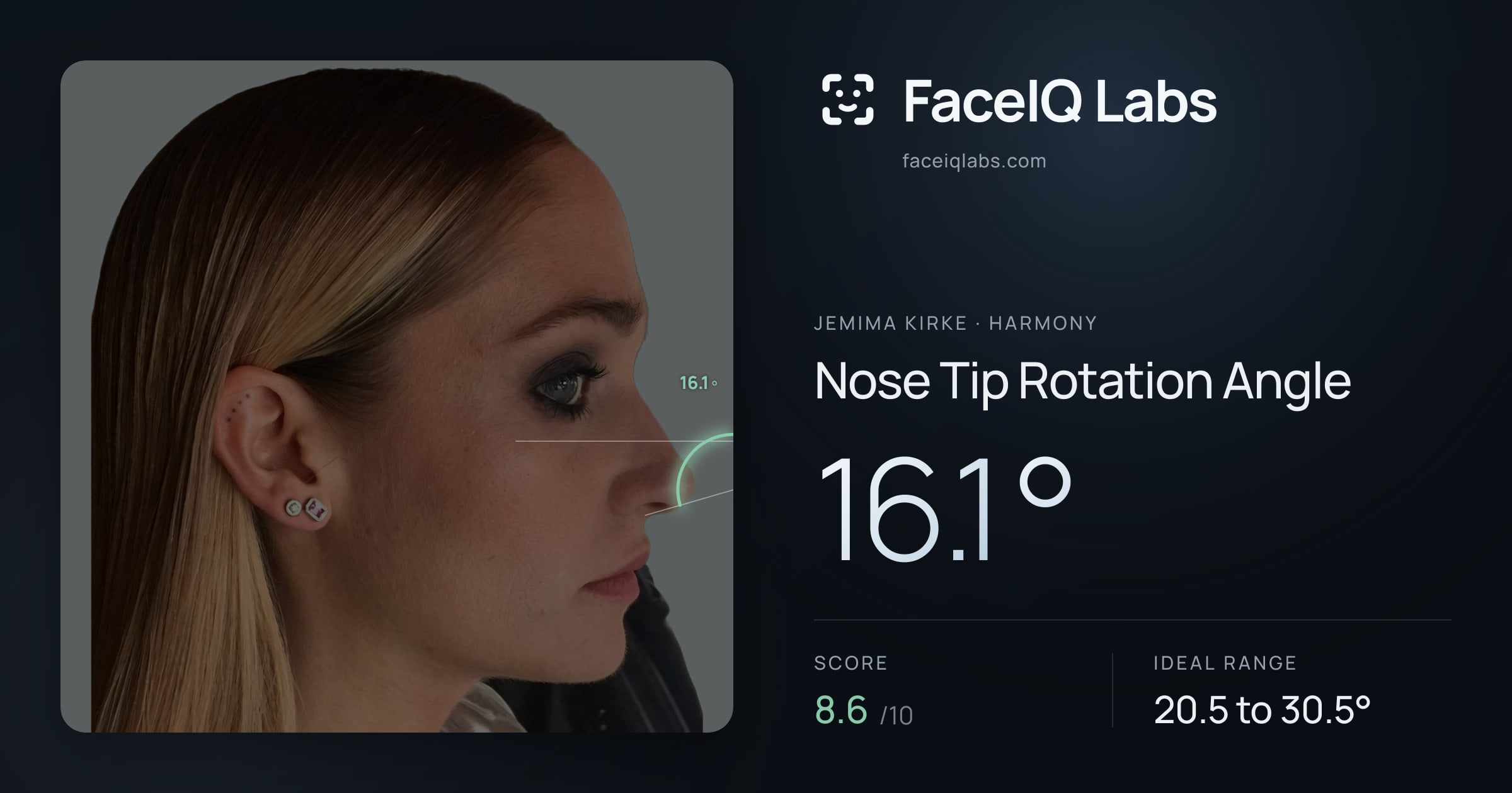 Jemima Kirke Nose Tip Rotation Angle: 16.1°, drawn on the photo