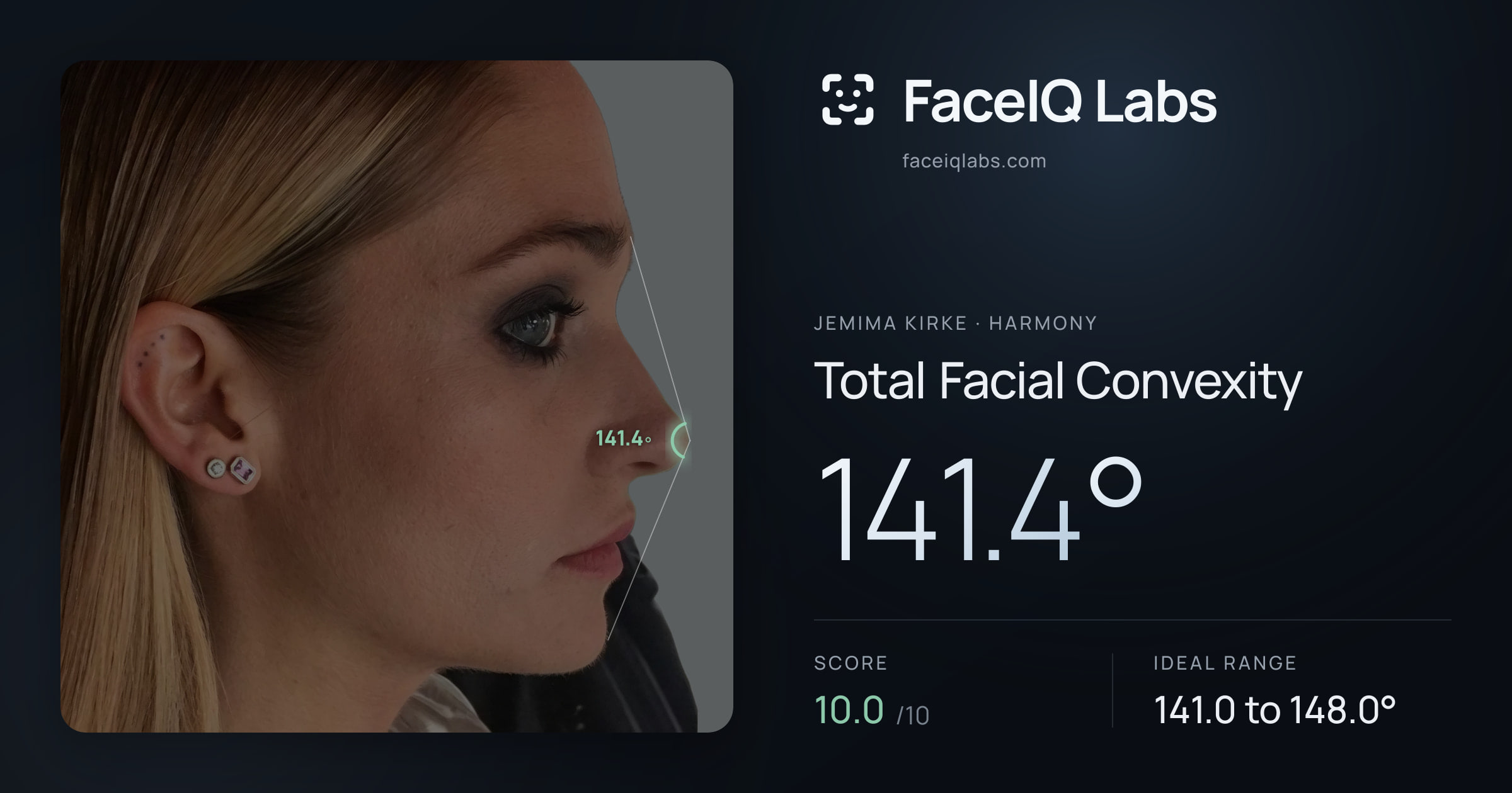 Jemima Kirke Total Facial Convexity: 141.4°, drawn on the photo