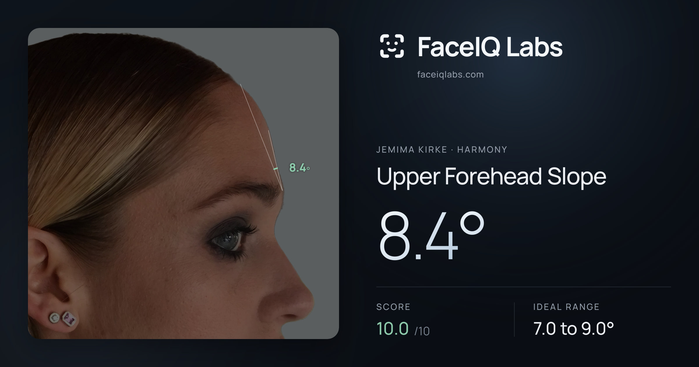 Jemima Kirke Upper Forehead Slope: 8.4°, drawn on the photo
