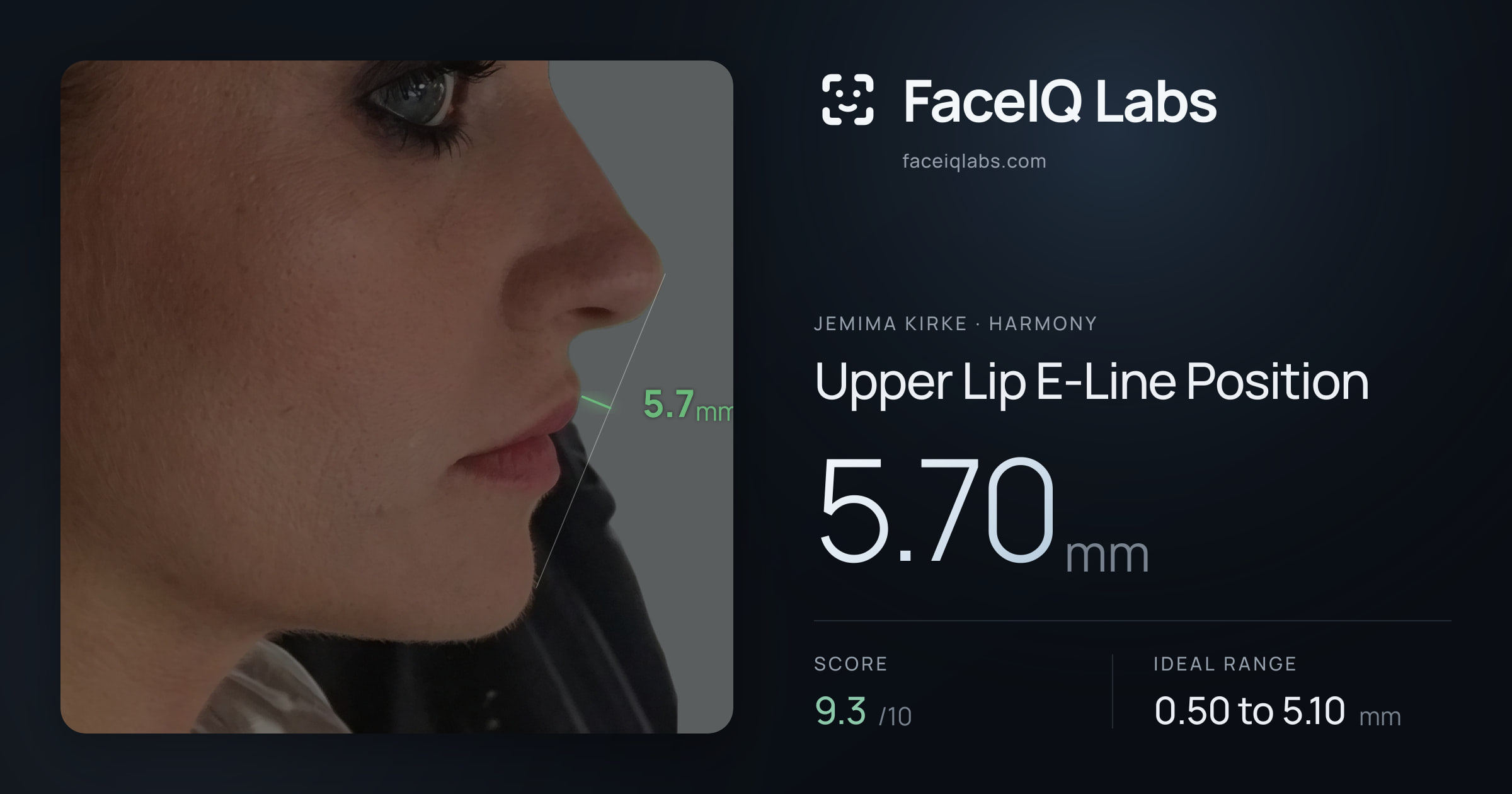 Jemima Kirke Upper Lip E-Line Position: 5.70mm, drawn on the photo