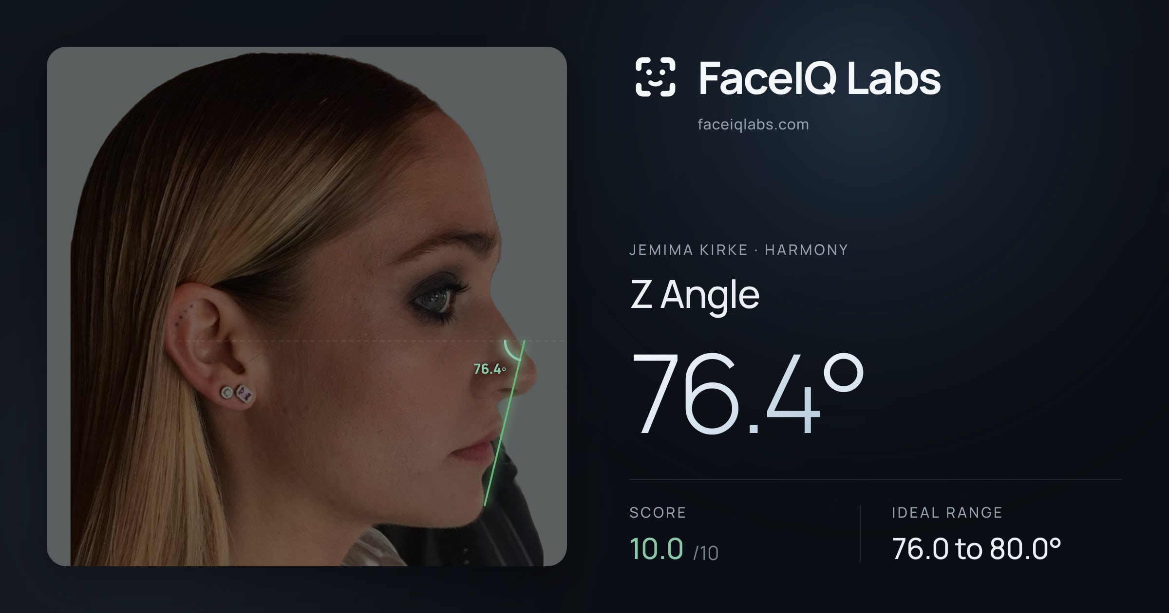 Jemima Kirke Z Angle: 76.4°, drawn on the photo