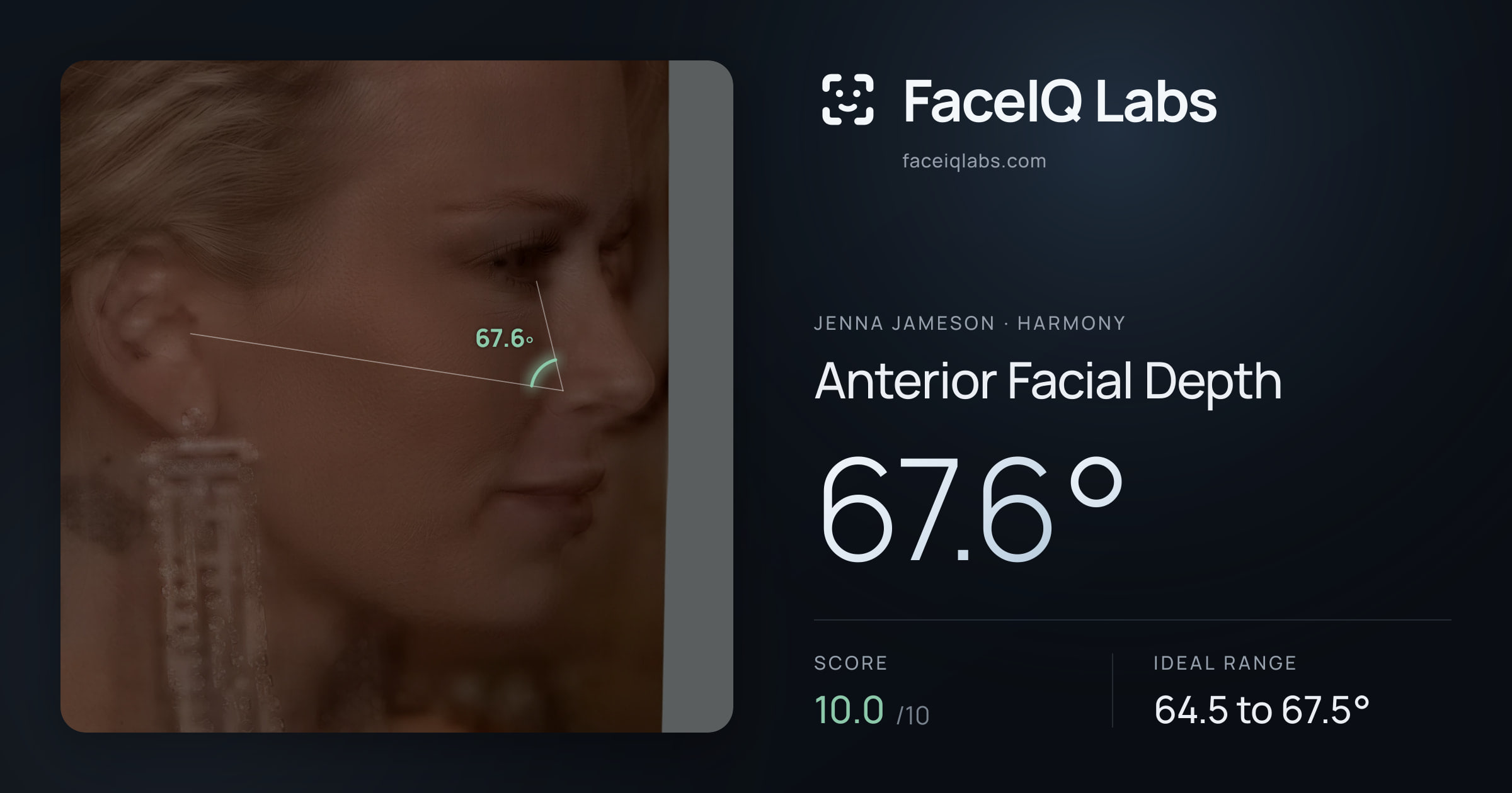 Jenna Jameson Anterior Facial Depth: 67.6°, drawn on the photo