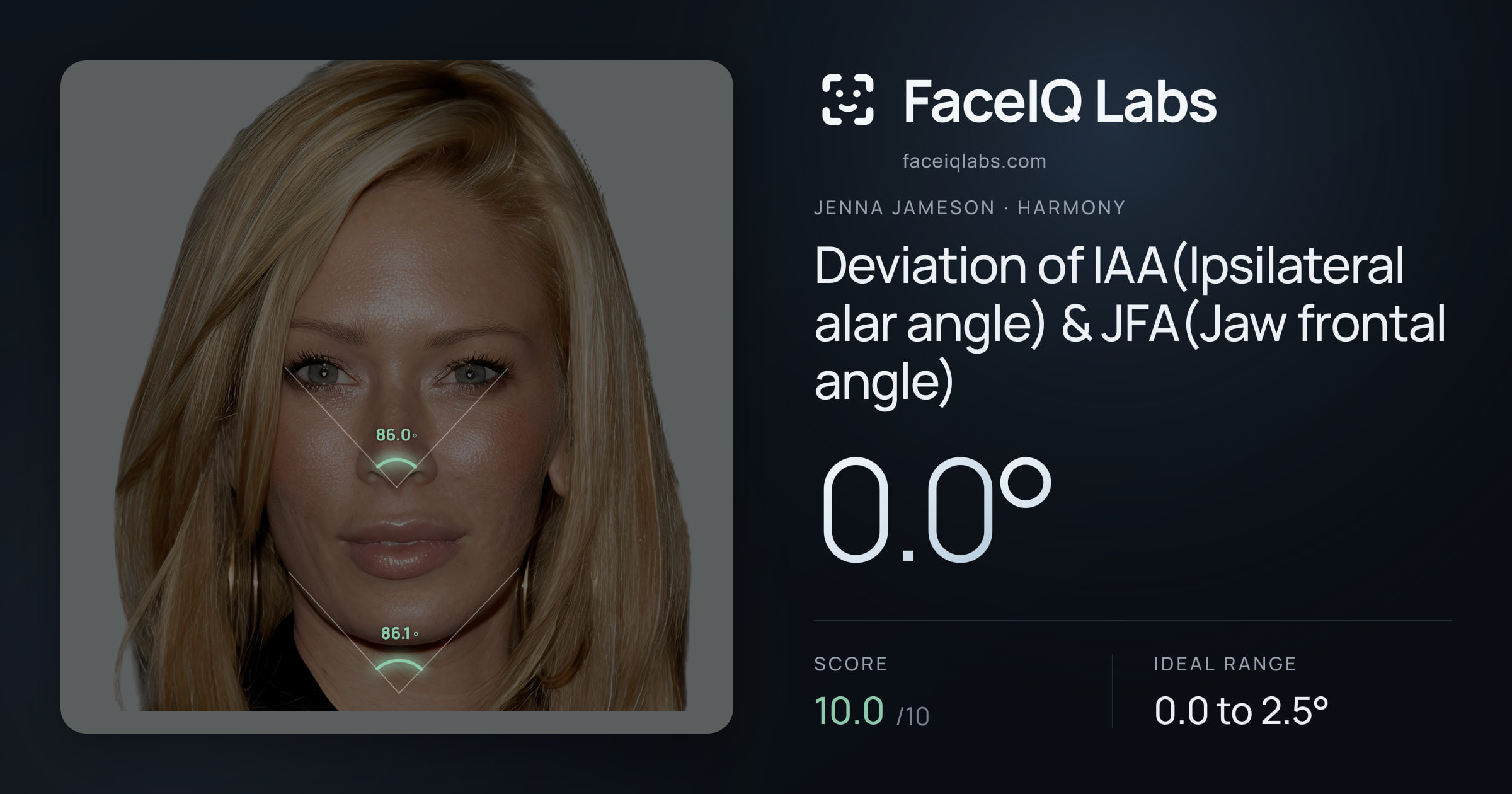 Jenna Jameson Deviation of IAA(Ipsilateral alar angle) & JFA(Jaw frontal angle): 0.0°, drawn on the photo