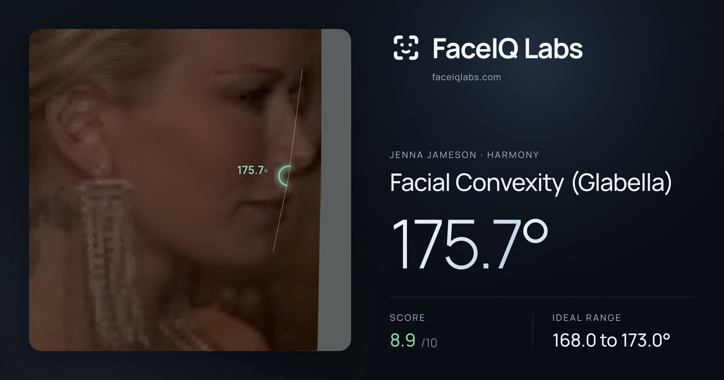 Jenna Jameson Facial Convexity (Glabella): 175.7°, drawn on the photo
