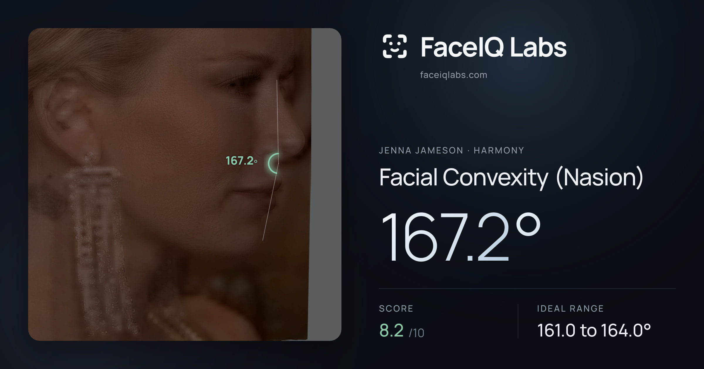 Jenna Jameson Facial Convexity (Nasion): 167.2°, drawn on the photo