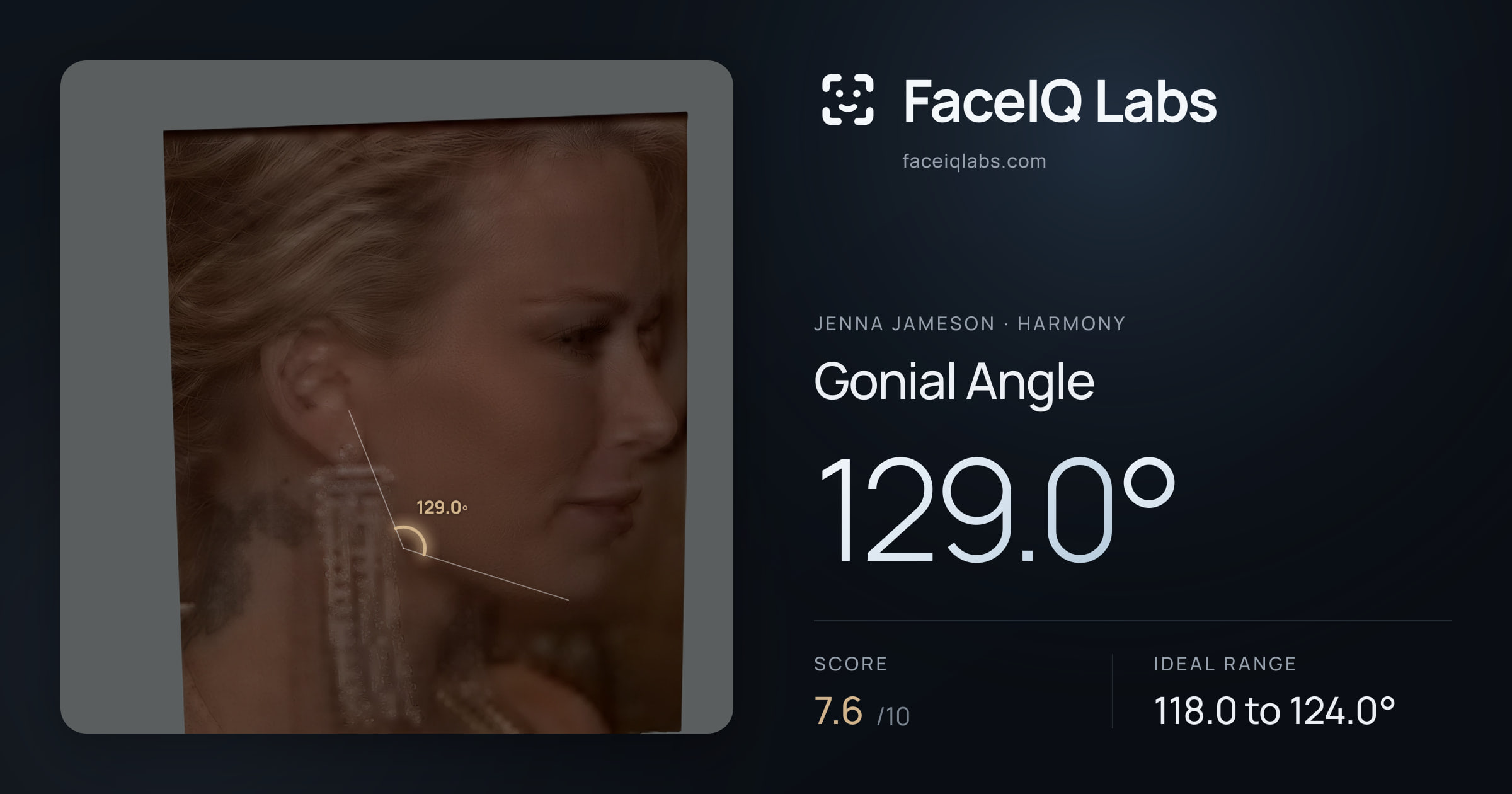 Jenna Jameson Gonial Angle: 129.0°, drawn on the photo