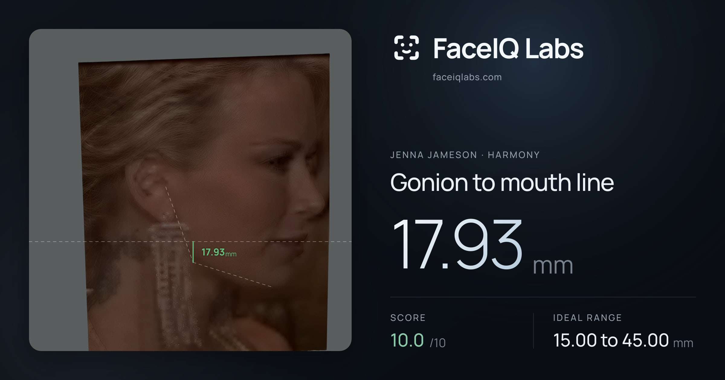 Jenna Jameson Gonion to mouth line: 17.93mm, drawn on the photo
