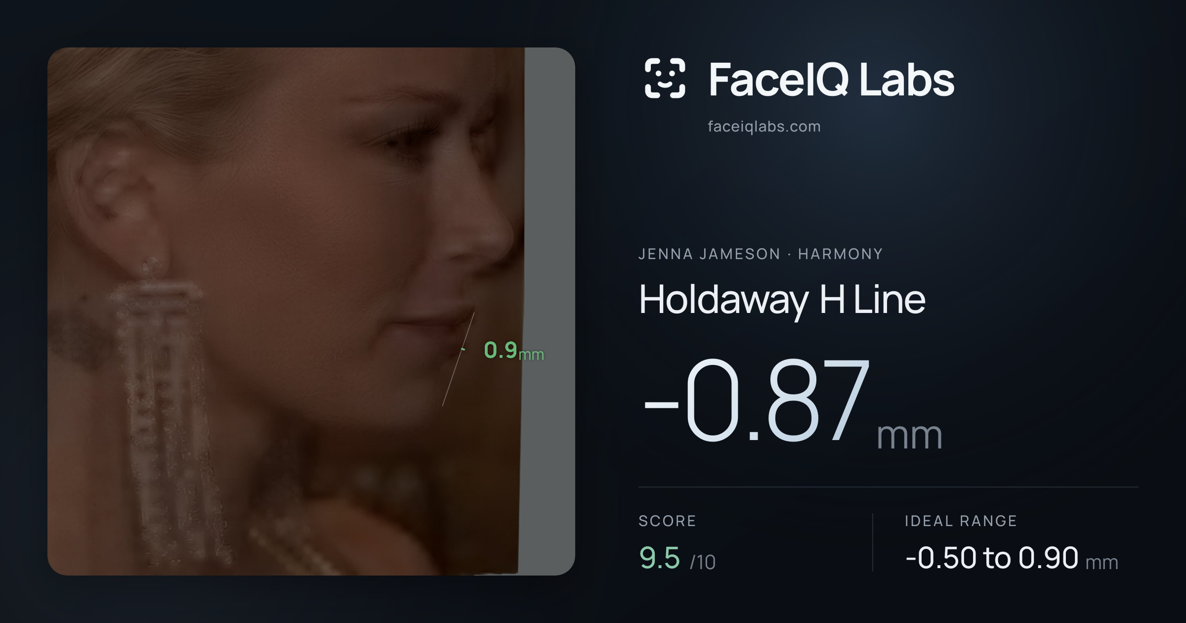 Jenna Jameson Holdaway H Line: -0.87mm, drawn on the photo