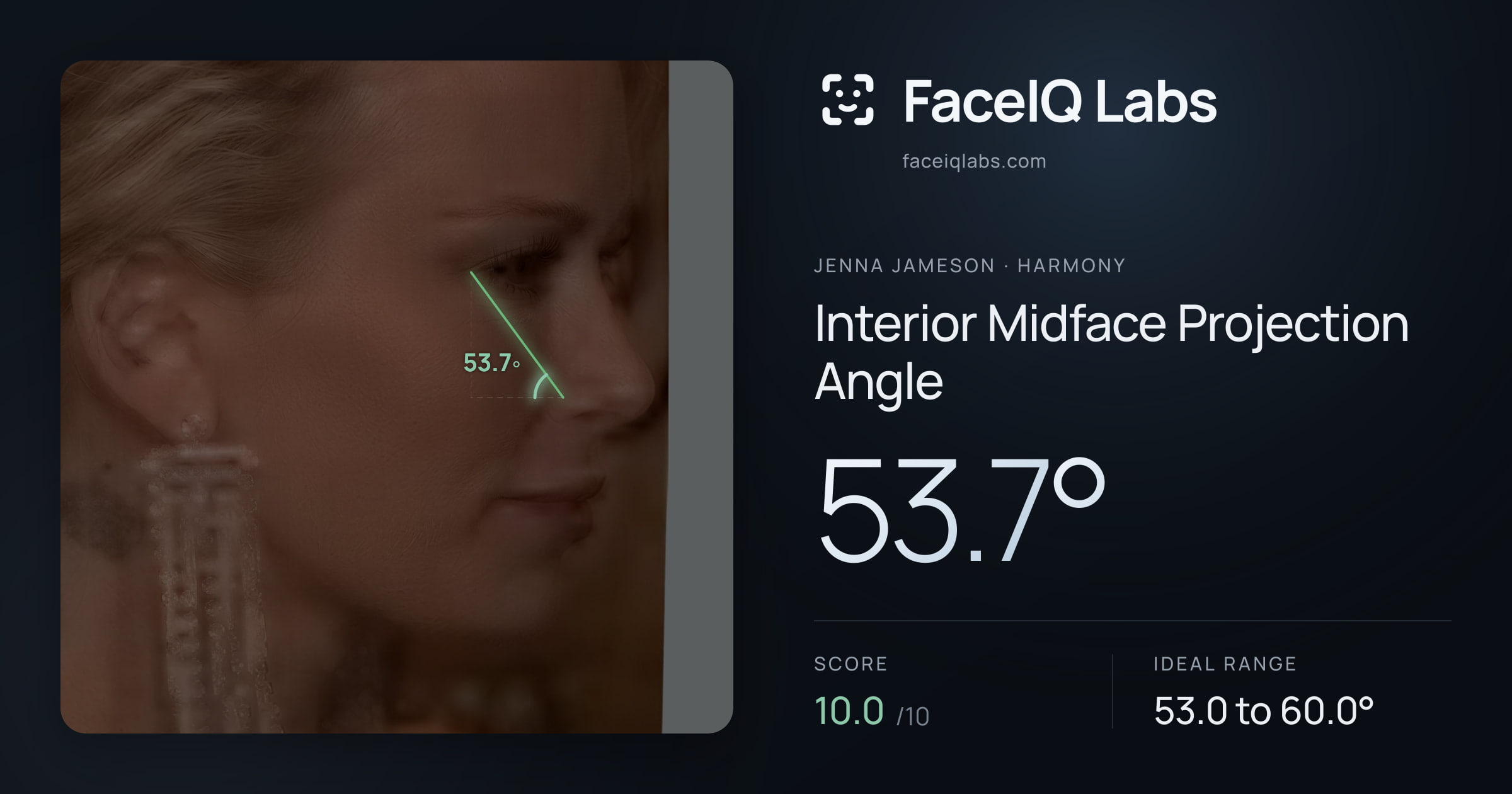 Jenna Jameson Interior Midface Projection Angle: 53.7°, drawn on the photo