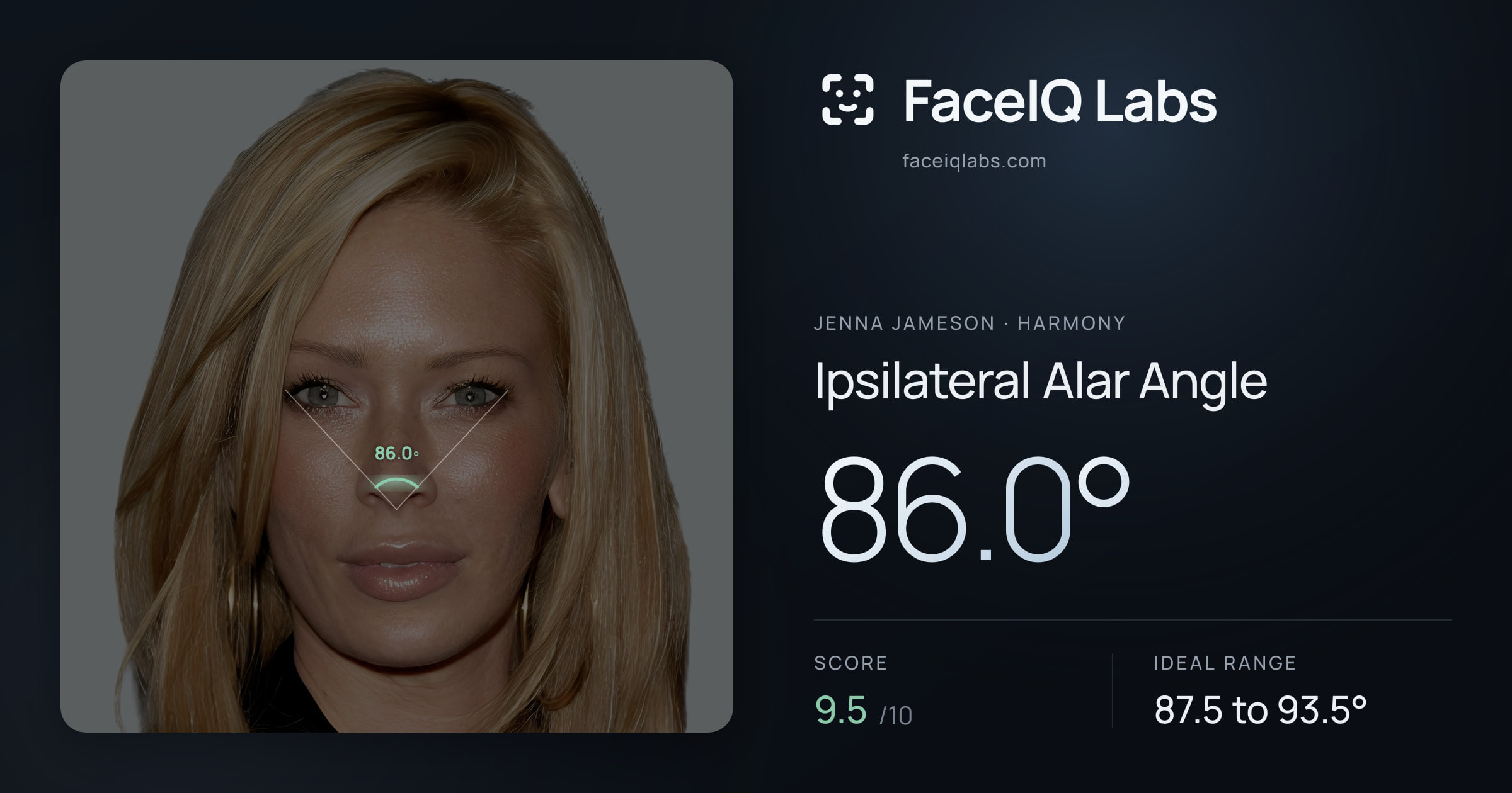Jenna Jameson Ipsilateral Alar Angle: 86.0°, drawn on the photo