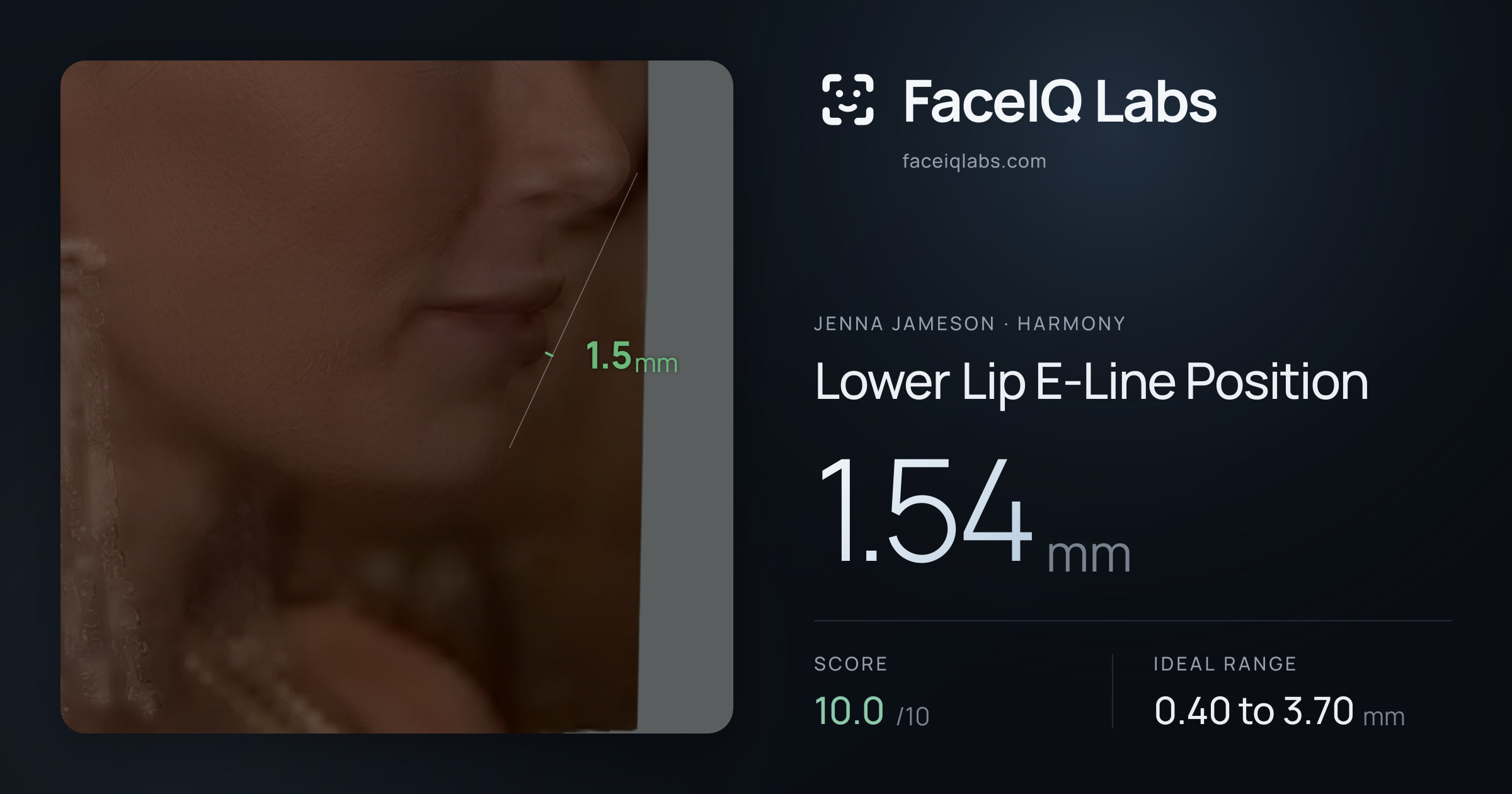Jenna Jameson Lower Lip E-Line Position: 1.54mm, drawn on the photo