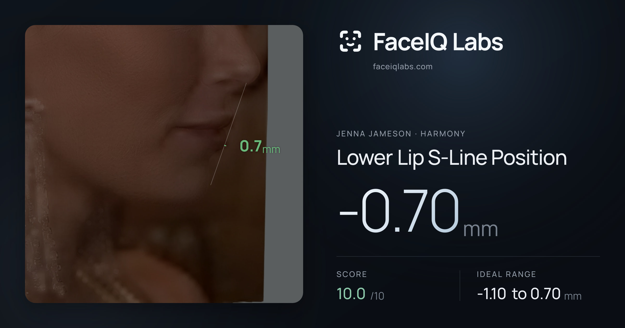 Jenna Jameson Lower Lip S-Line Position: -0.70mm, drawn on the photo