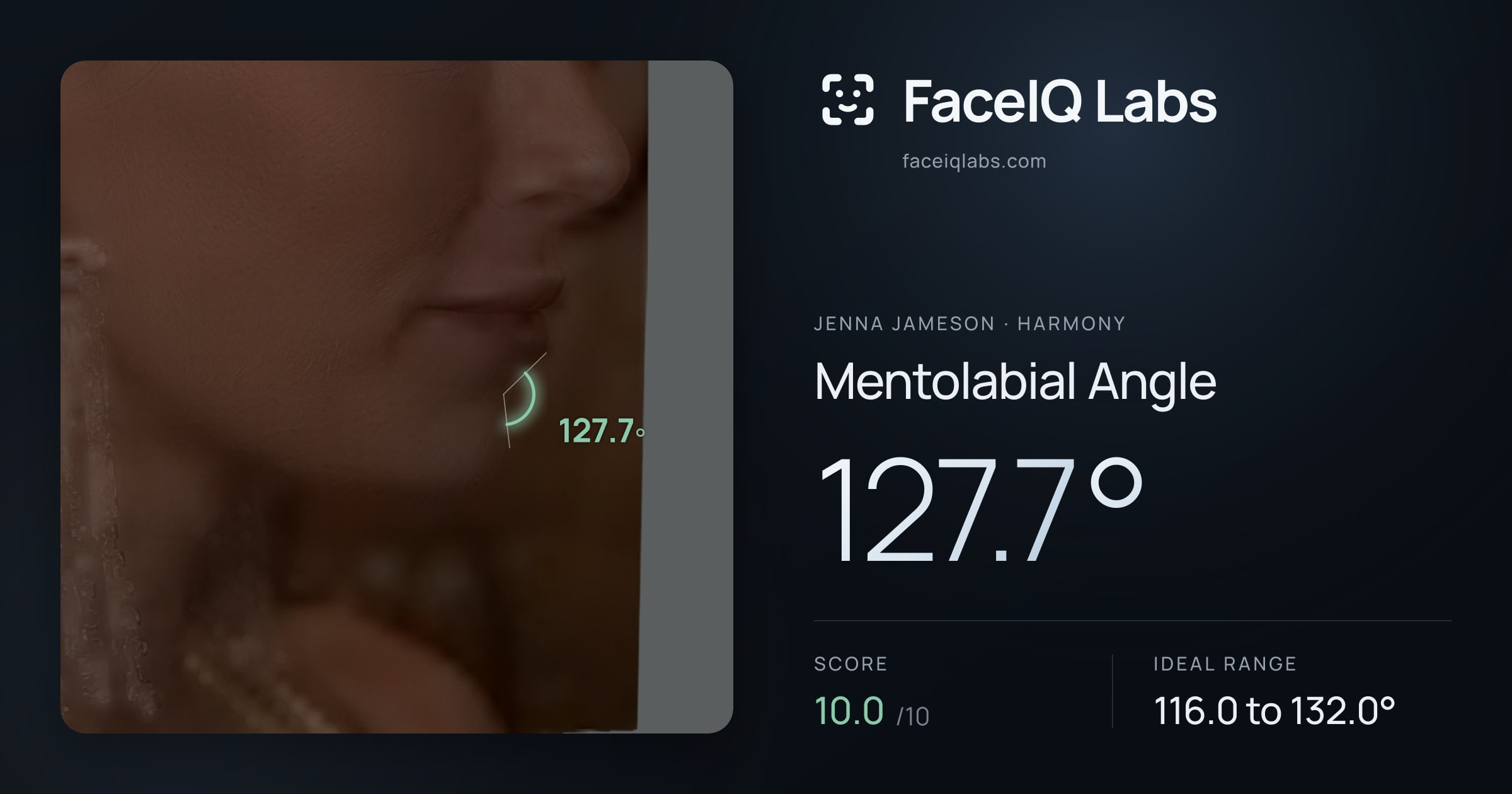 Jenna Jameson Mentolabial Angle: 127.7°, drawn on the photo