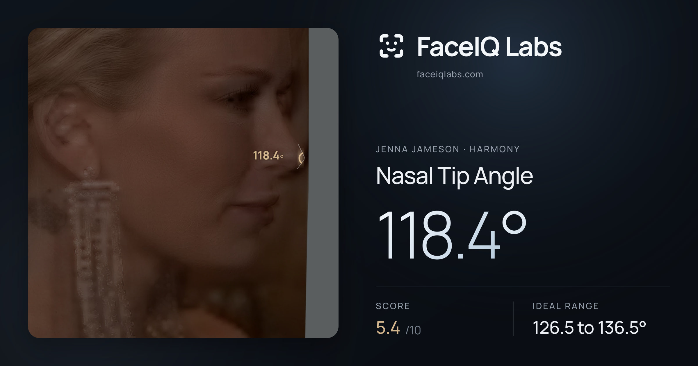 Jenna Jameson Nasal Tip Angle: 118.4°, drawn on the photo