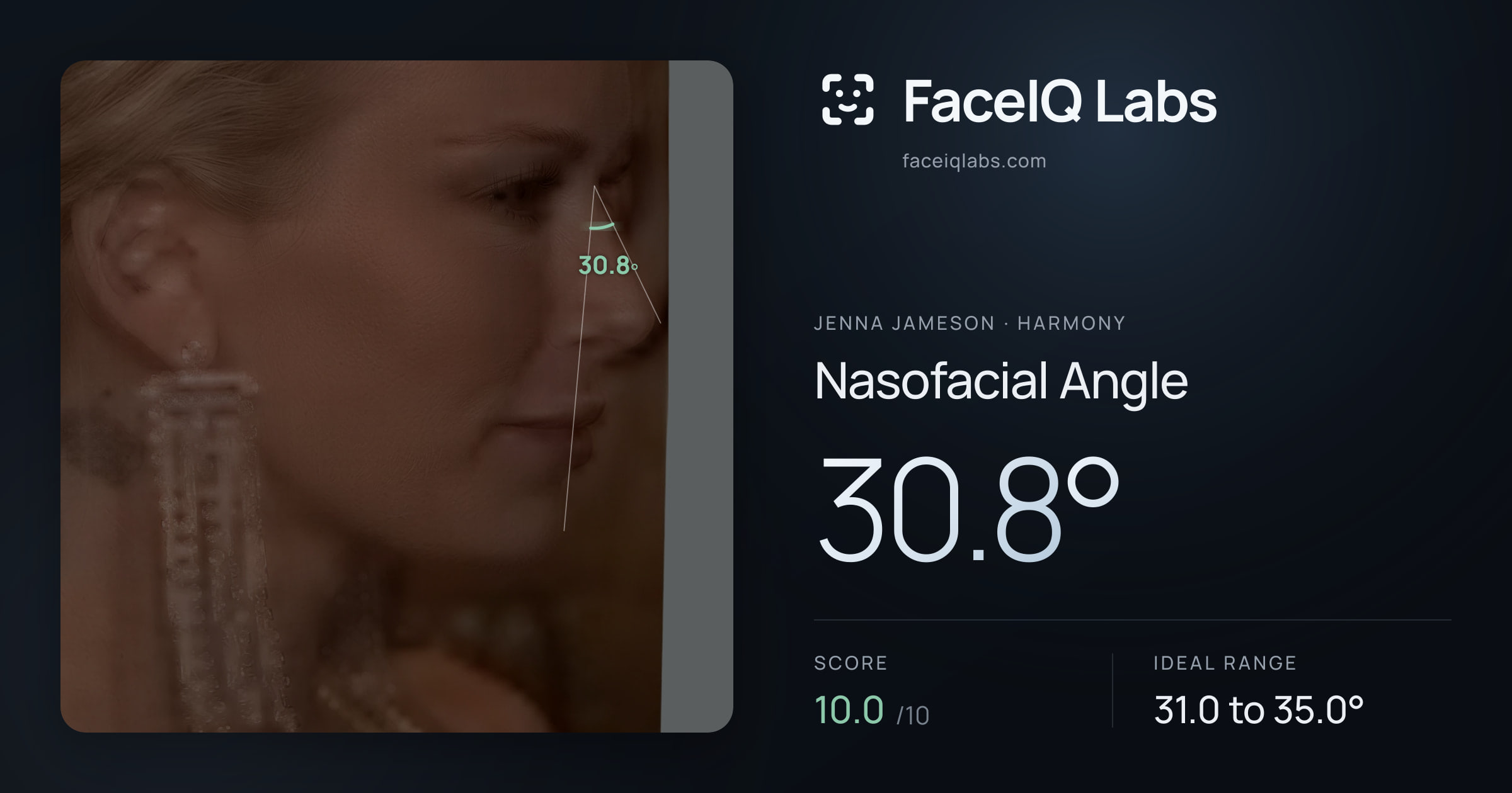 Jenna Jameson Nasofacial Angle: 30.8°, drawn on the photo