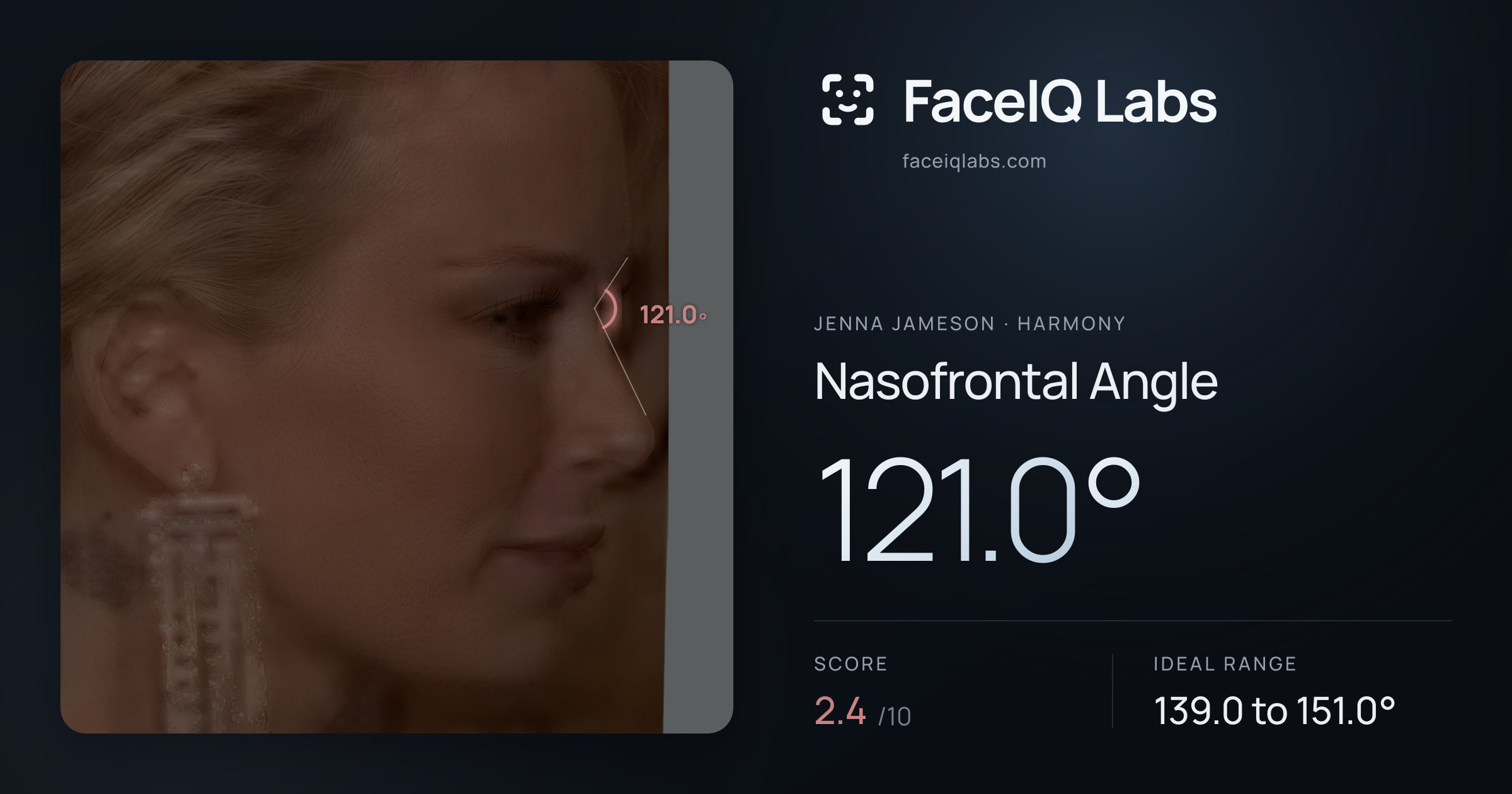 Jenna Jameson Nasofrontal Angle: 121.0°, drawn on the photo