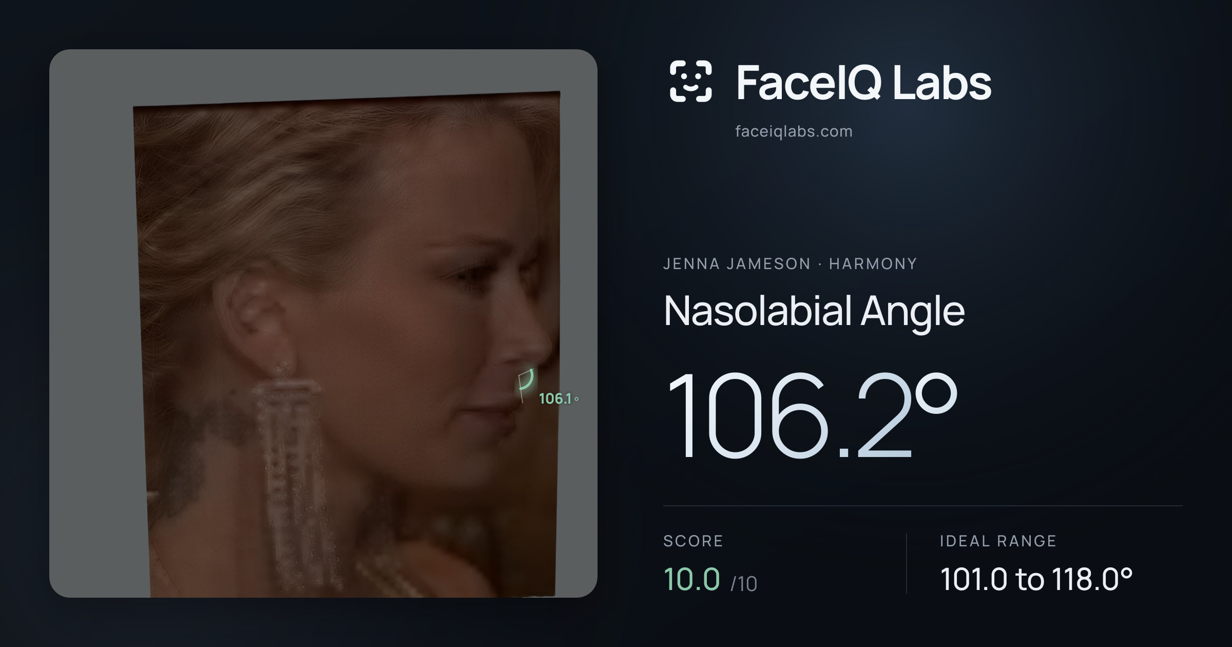 Jenna Jameson Nasolabial Angle: 106.2°, drawn on the photo