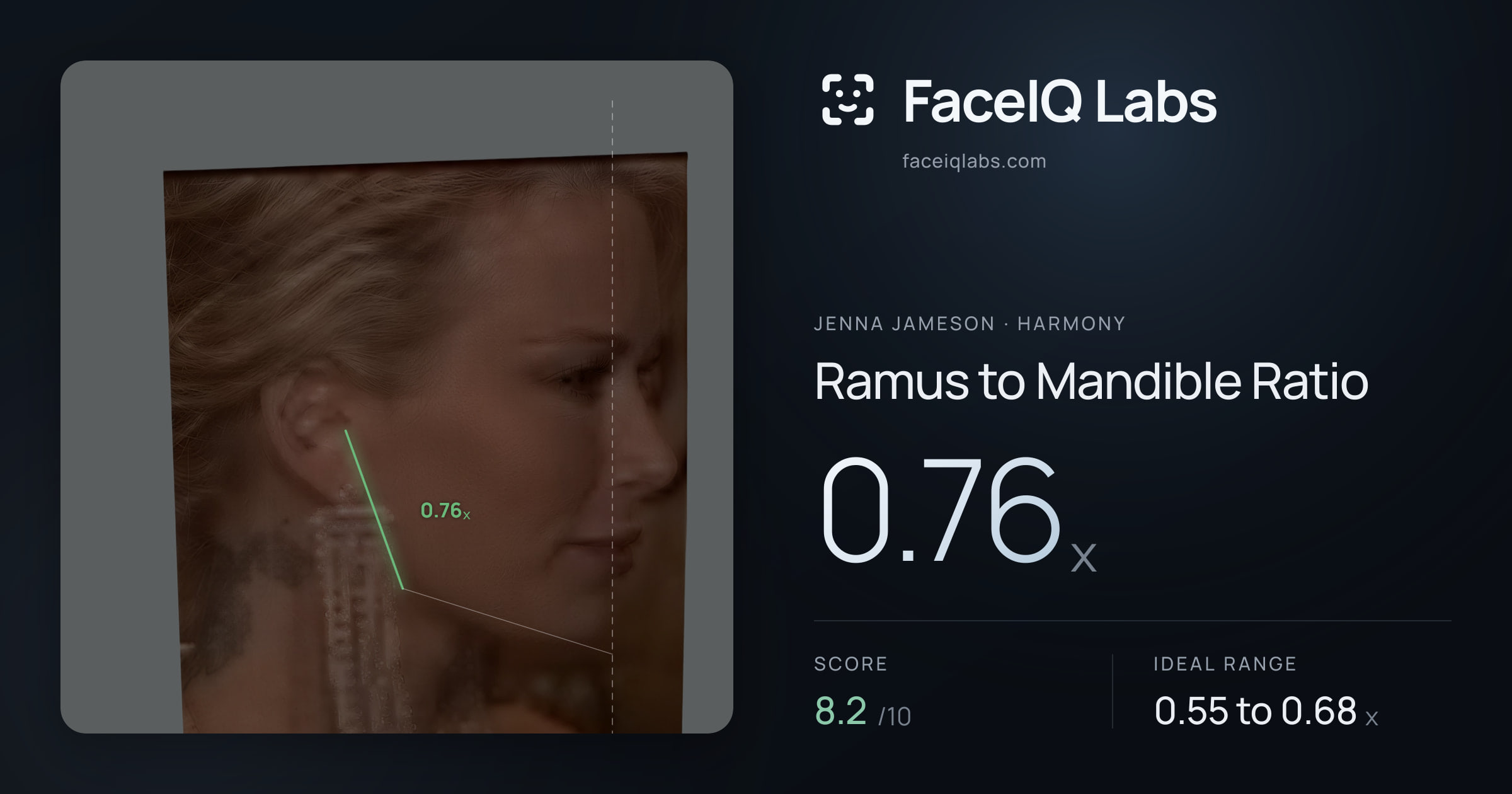 Jenna Jameson Ramus to Mandible Ratio: 0.76x, drawn on the photo
