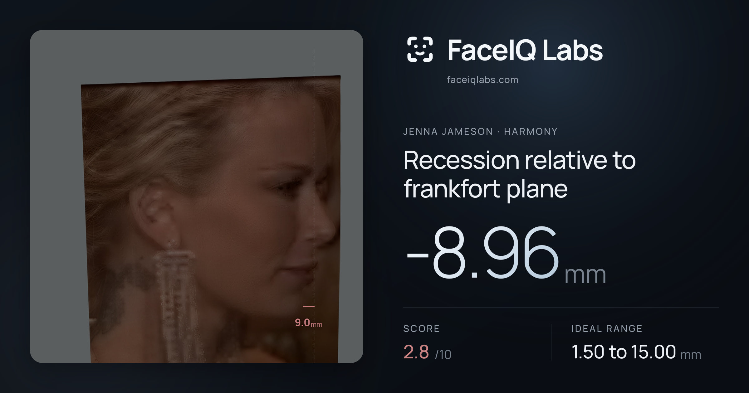 Jenna Jameson Recession relative to frankfort plane: -8.96mm, drawn on the photo