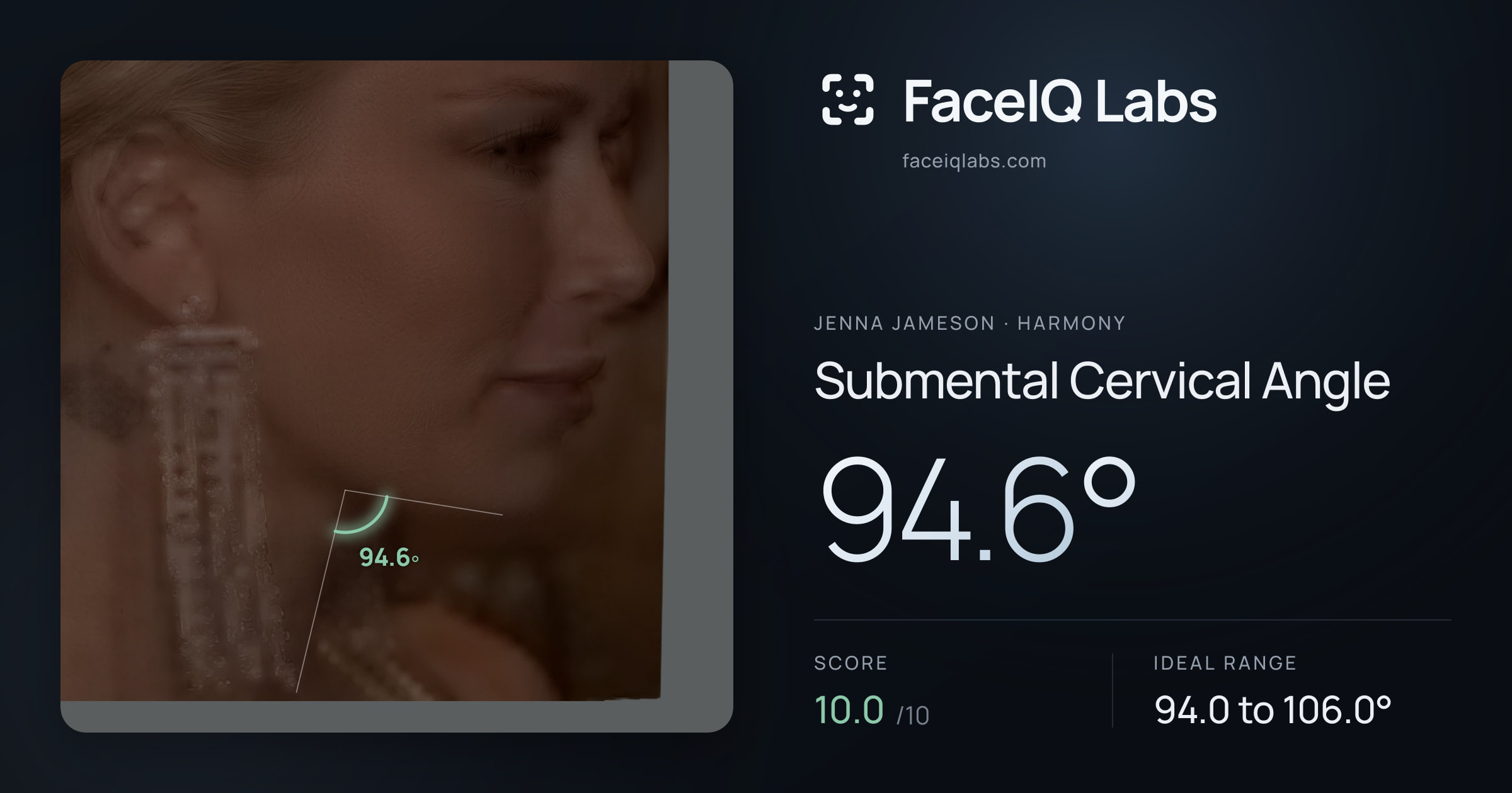 Jenna Jameson Submental Cervical Angle: 94.6°, drawn on the photo