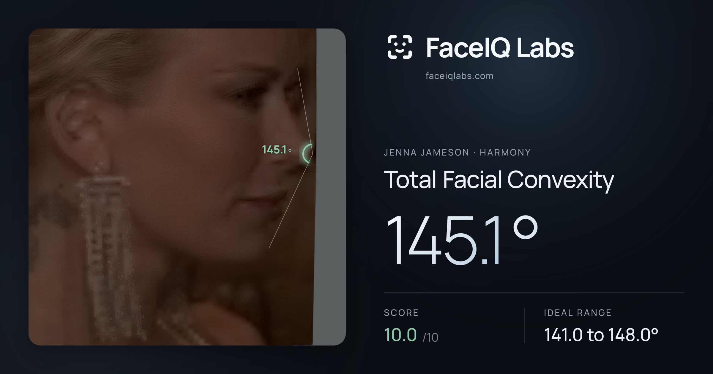 Jenna Jameson Total Facial Convexity: 145.1°, drawn on the photo