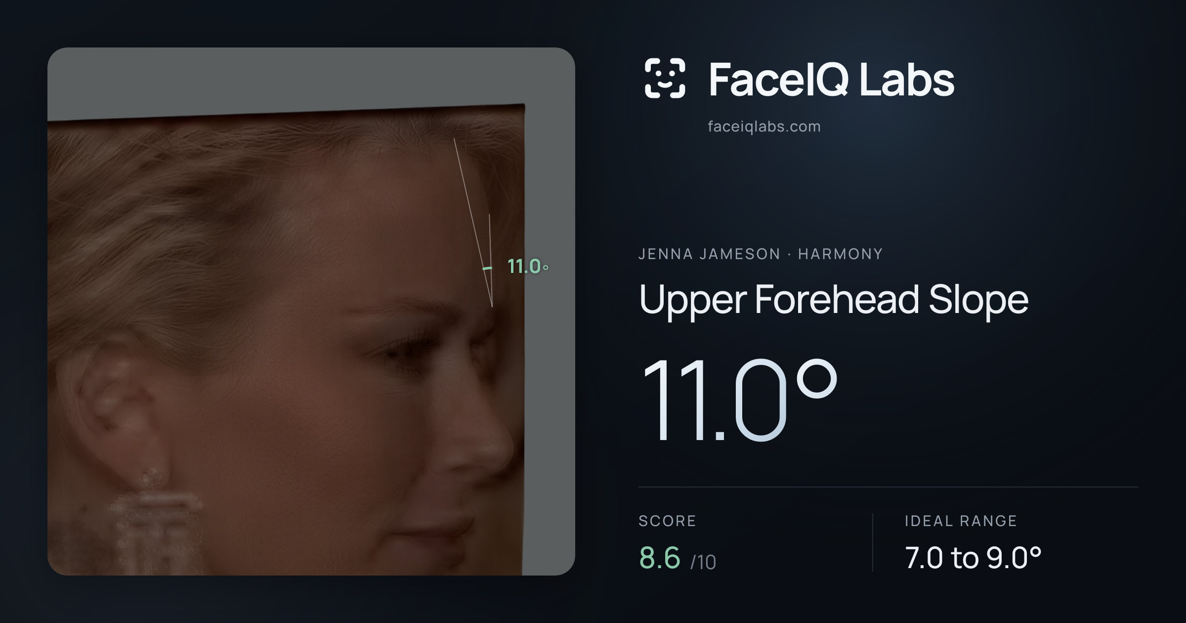 Jenna Jameson Upper Forehead Slope: 11.0°, drawn on the photo