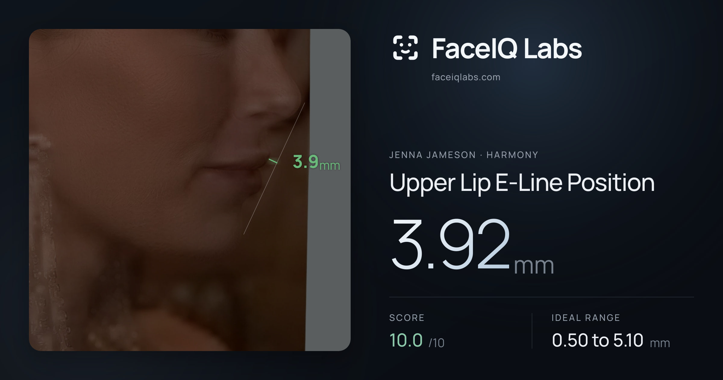 Jenna Jameson Upper Lip E-Line Position: 3.92mm, drawn on the photo