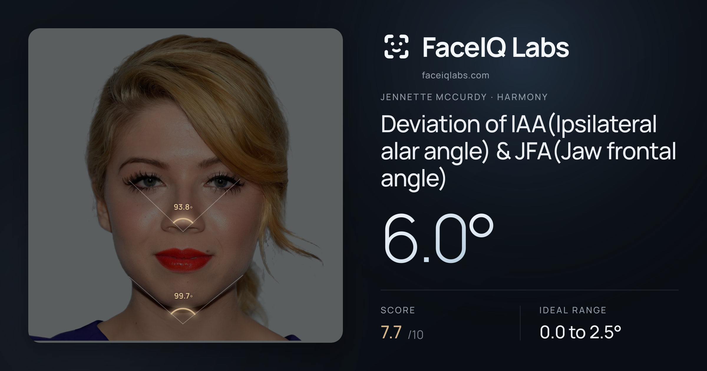 Jennette McCurdy Deviation of IAA(Ipsilateral alar angle) & JFA(Jaw frontal angle): 6.0°, drawn on the photo