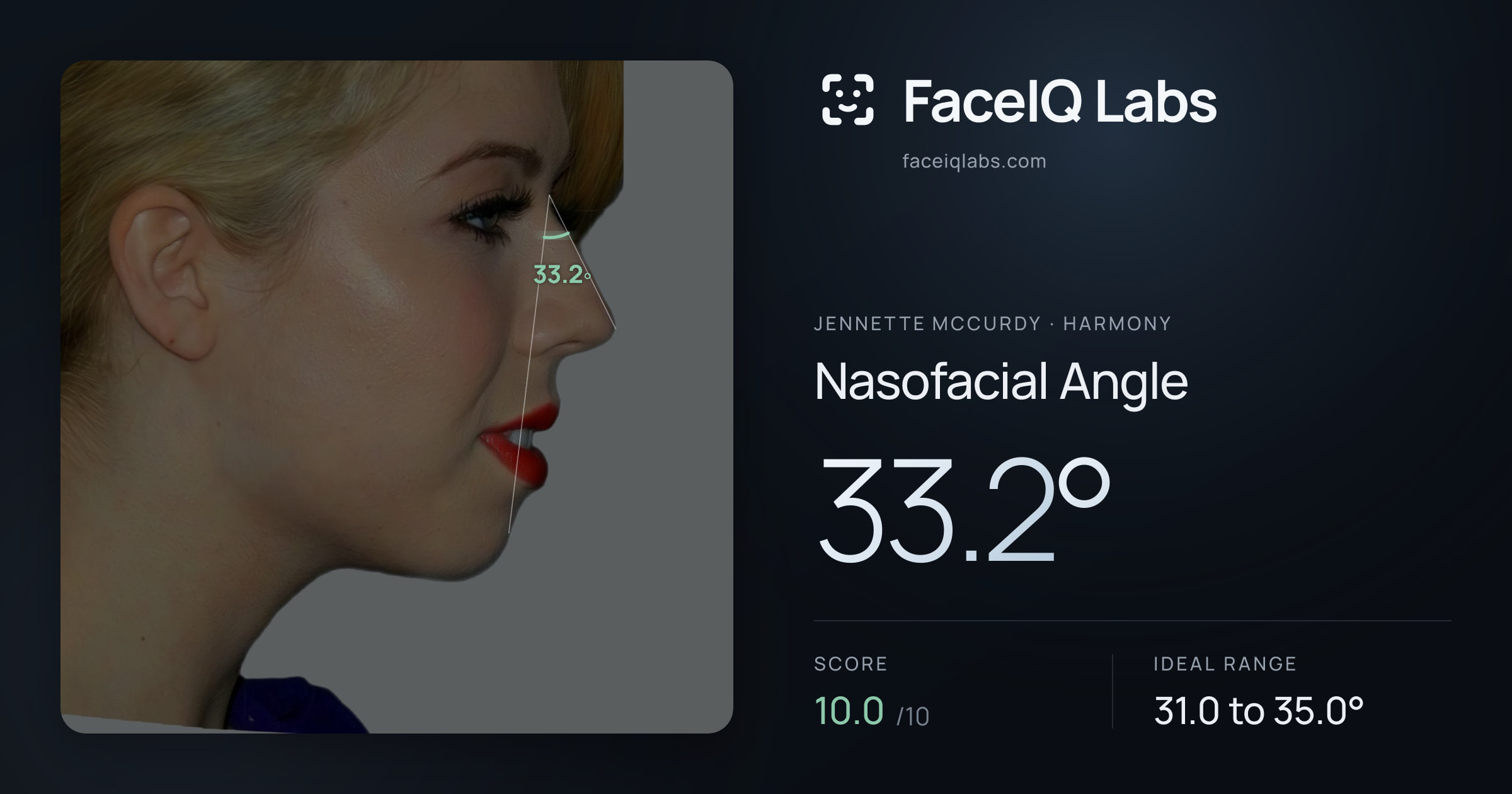 Jennette McCurdy Nasofacial Angle: 33.2°, drawn on the photo