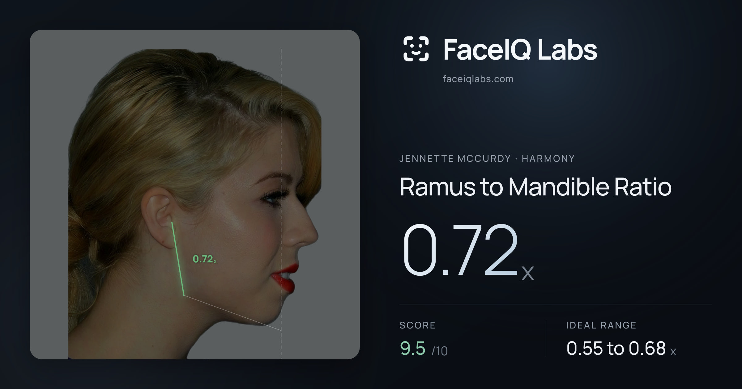Jennette McCurdy Ramus to Mandible Ratio: 0.72x, drawn on the photo