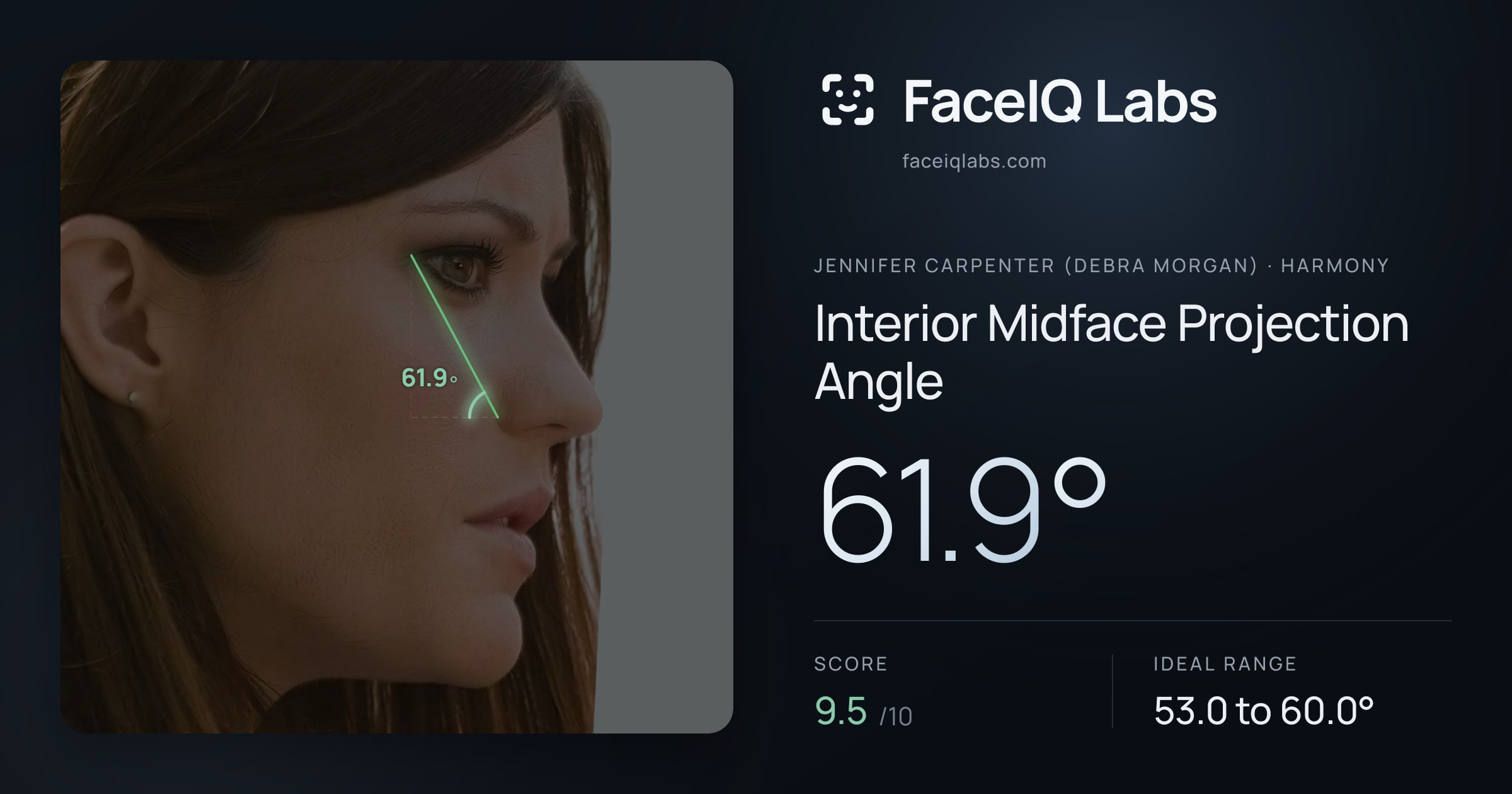 Jennifer Carpenter (Debra Morgan) Interior Midface Projection Angle: 61.9°, drawn on the photo