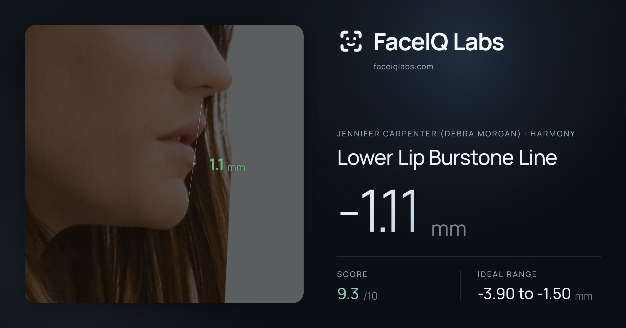 Jennifer Carpenter (Debra Morgan) Lower Lip Burstone Line: -1.11mm, drawn on the photo