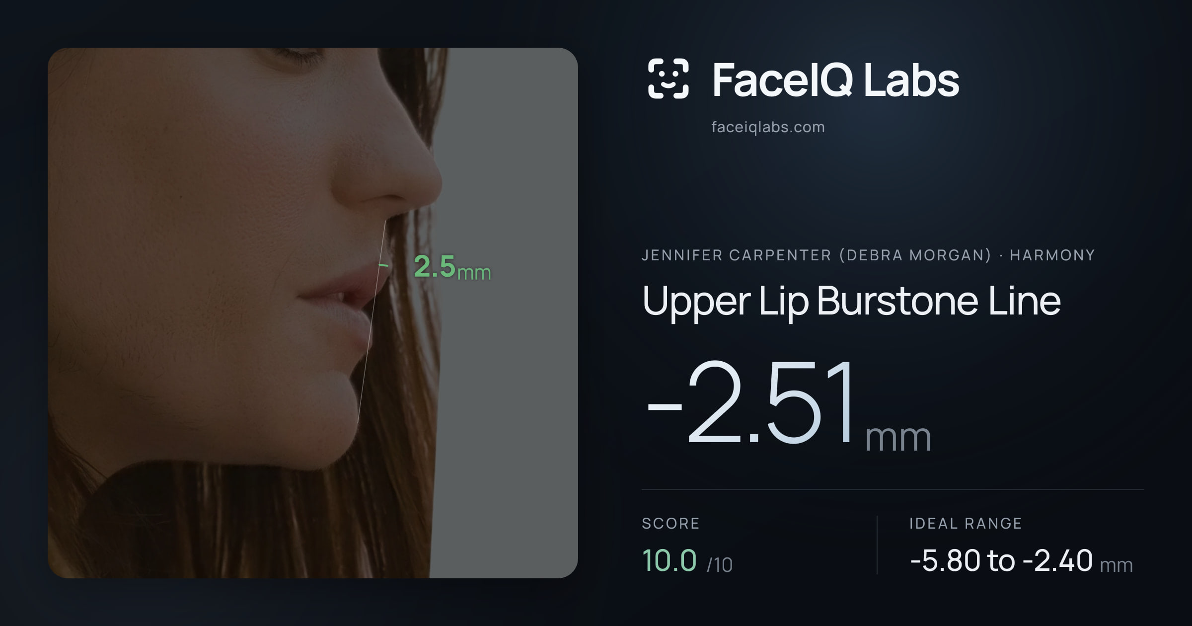 Jennifer Carpenter (Debra Morgan) Upper Lip Burstone Line: -2.51mm, drawn on the photo