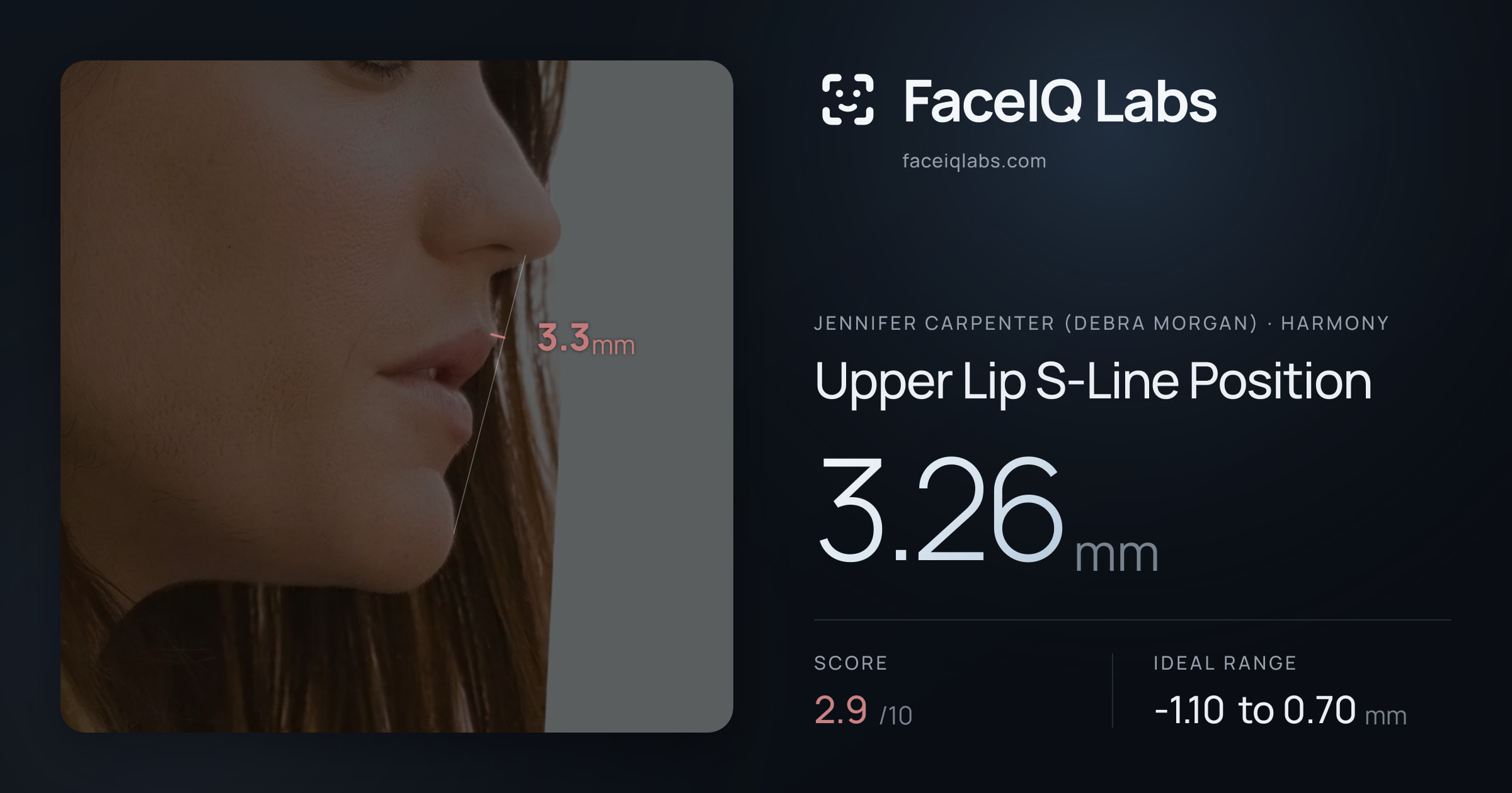 Jennifer Carpenter (Debra Morgan) Upper Lip S-Line Position: 3.26mm, drawn on the photo