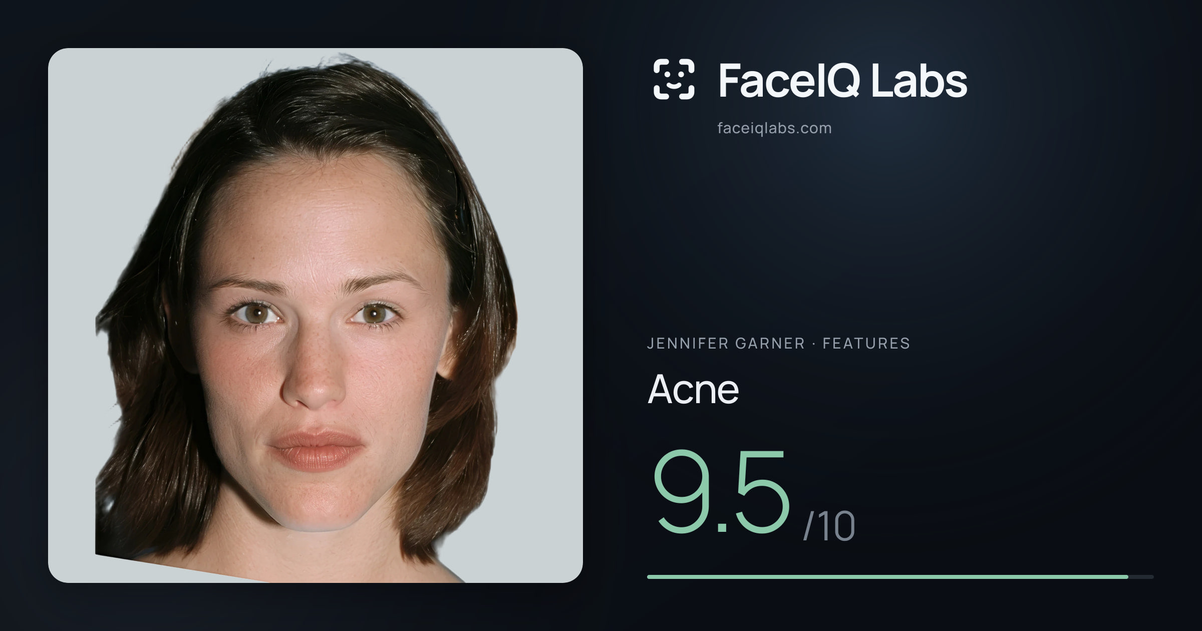 Jennifer Garner Acne: 9.5/10, drawn on the photo