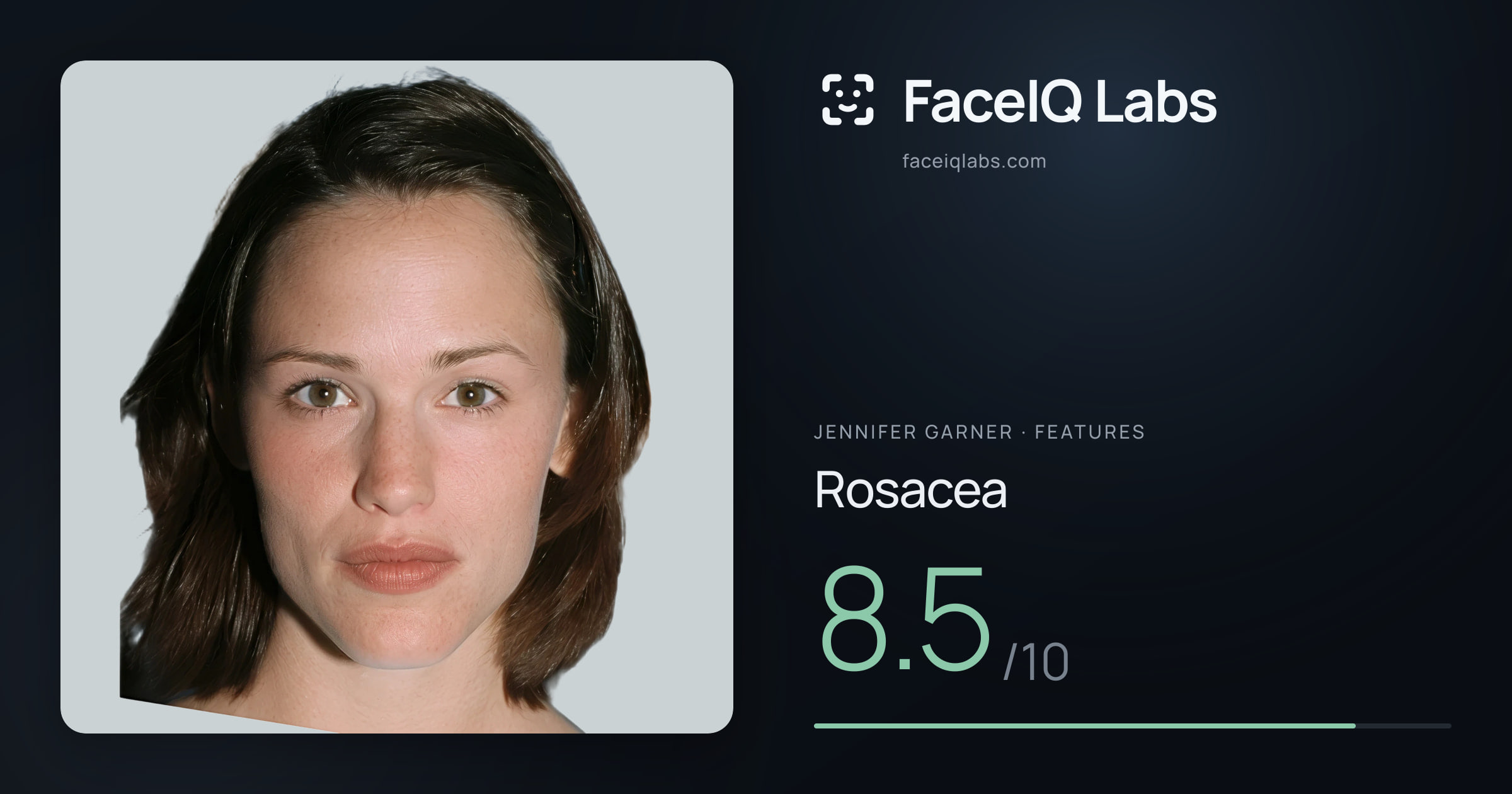 Jennifer Garner Rosacea: 8.5/10, drawn on the photo