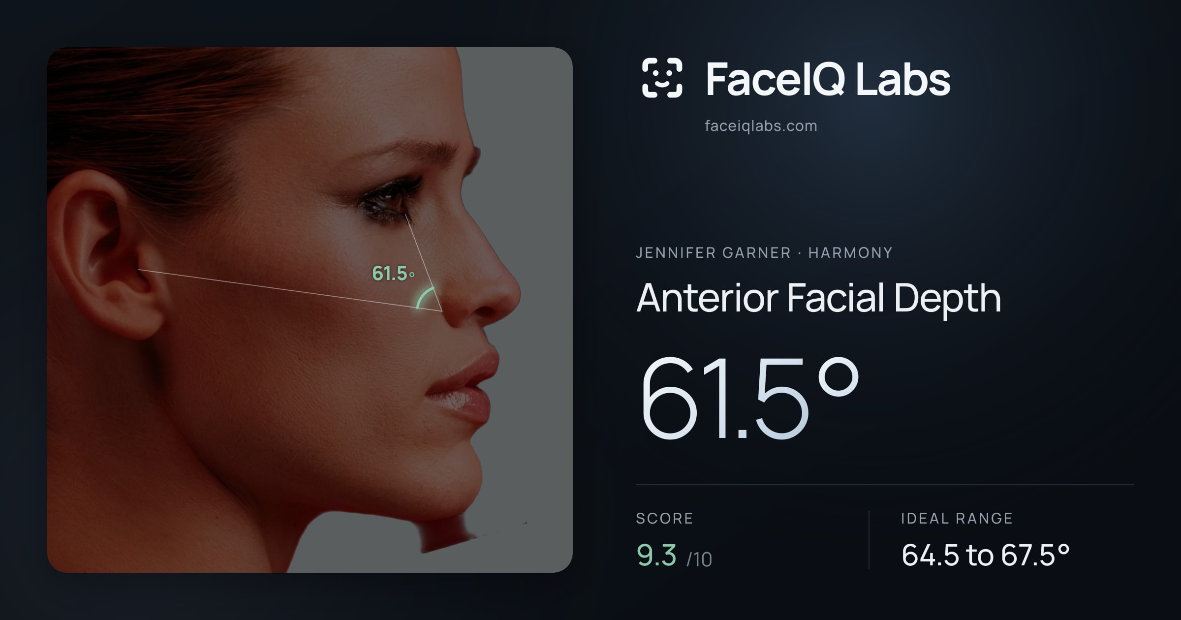 Jennifer Garner Anterior Facial Depth: 61.5°, drawn on the photo