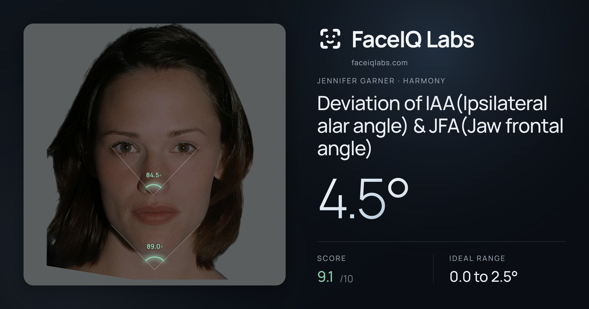 Jennifer Garner Deviation of IAA(Ipsilateral alar angle) & JFA(Jaw frontal angle): 4.5°, drawn on the photo