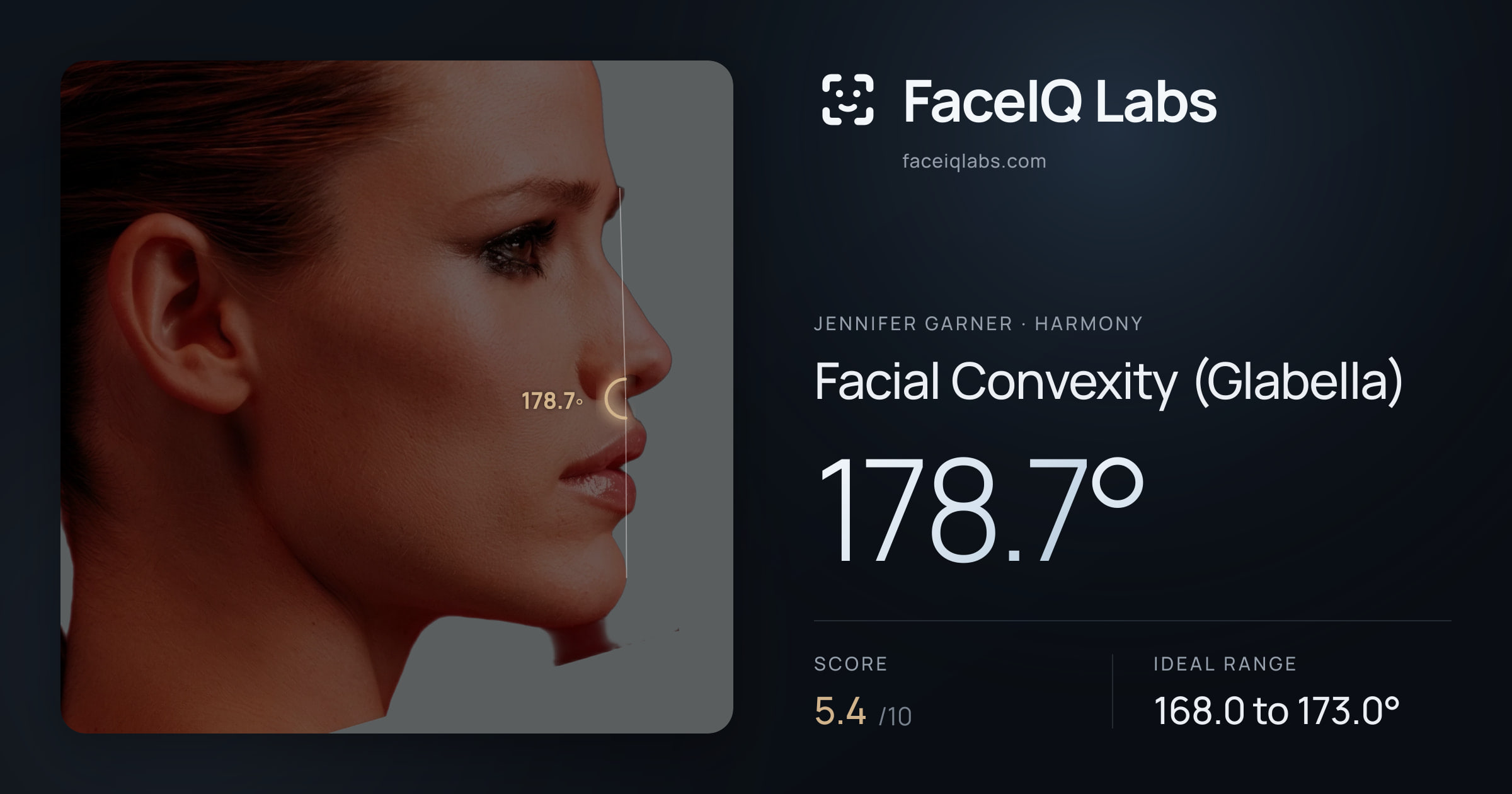 Jennifer Garner Facial Convexity (Glabella): 178.7°, drawn on the photo