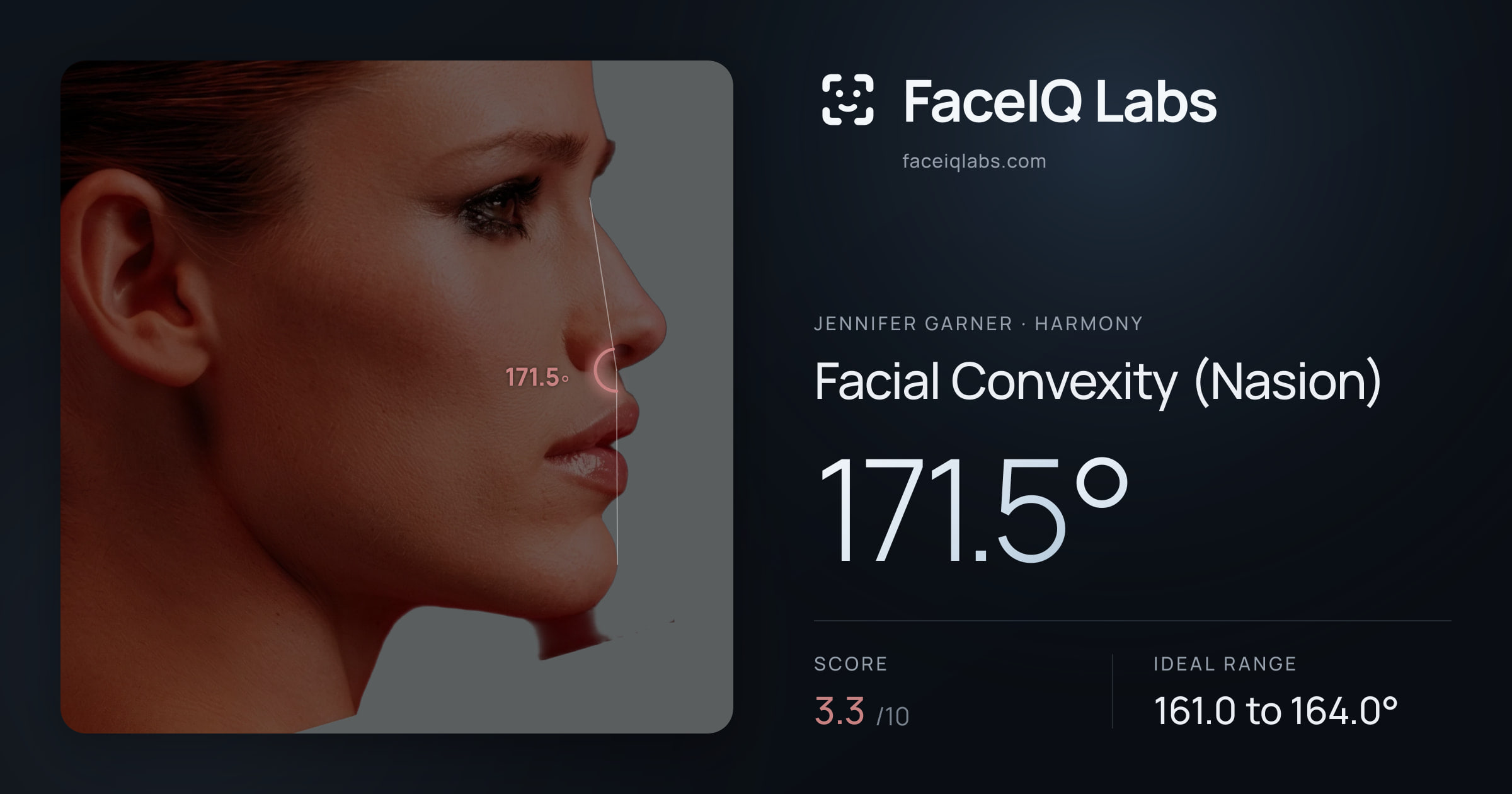 Jennifer Garner Facial Convexity (Nasion): 171.5°, drawn on the photo