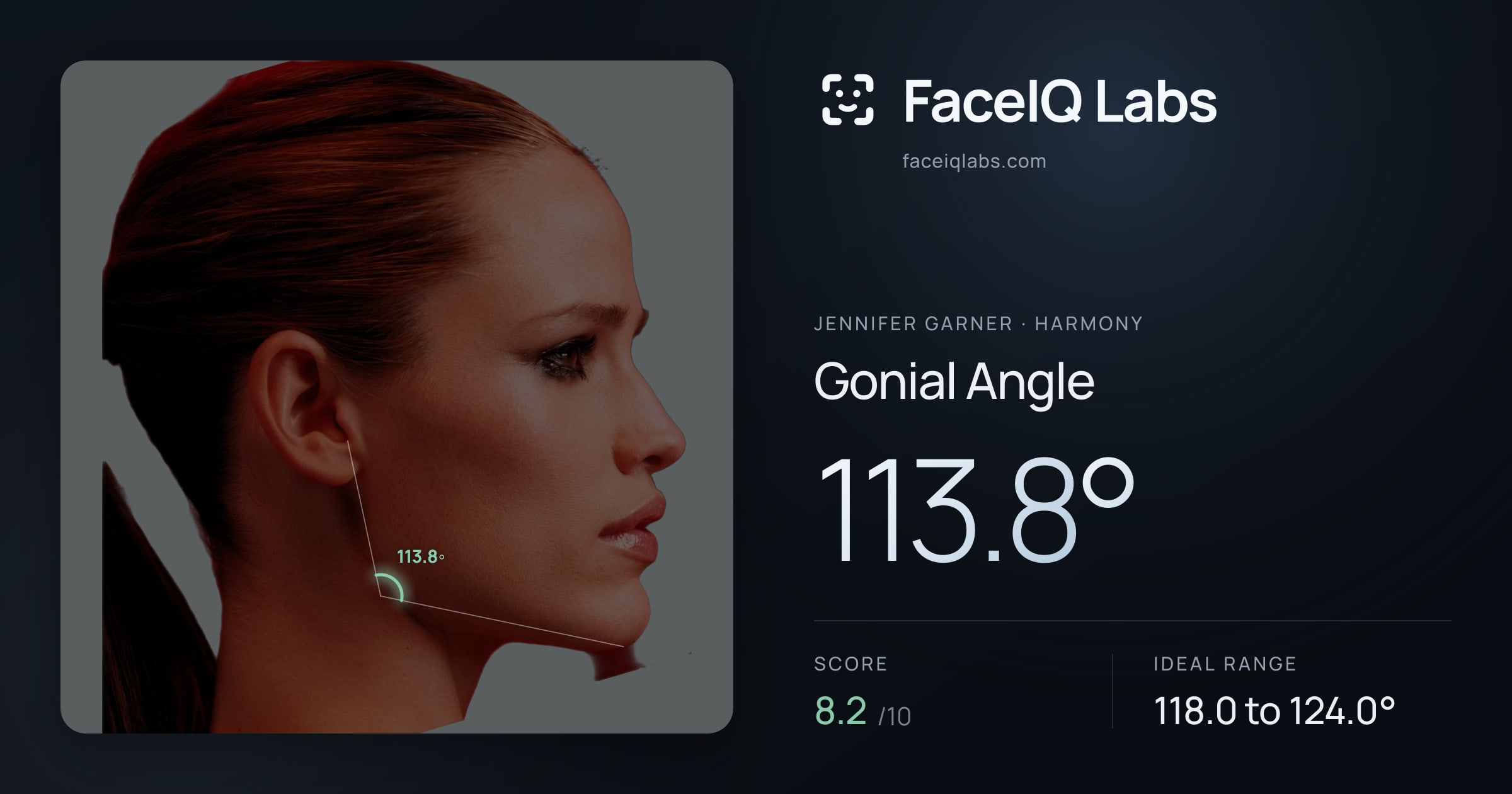Jennifer Garner Gonial Angle: 113.8°, drawn on the photo