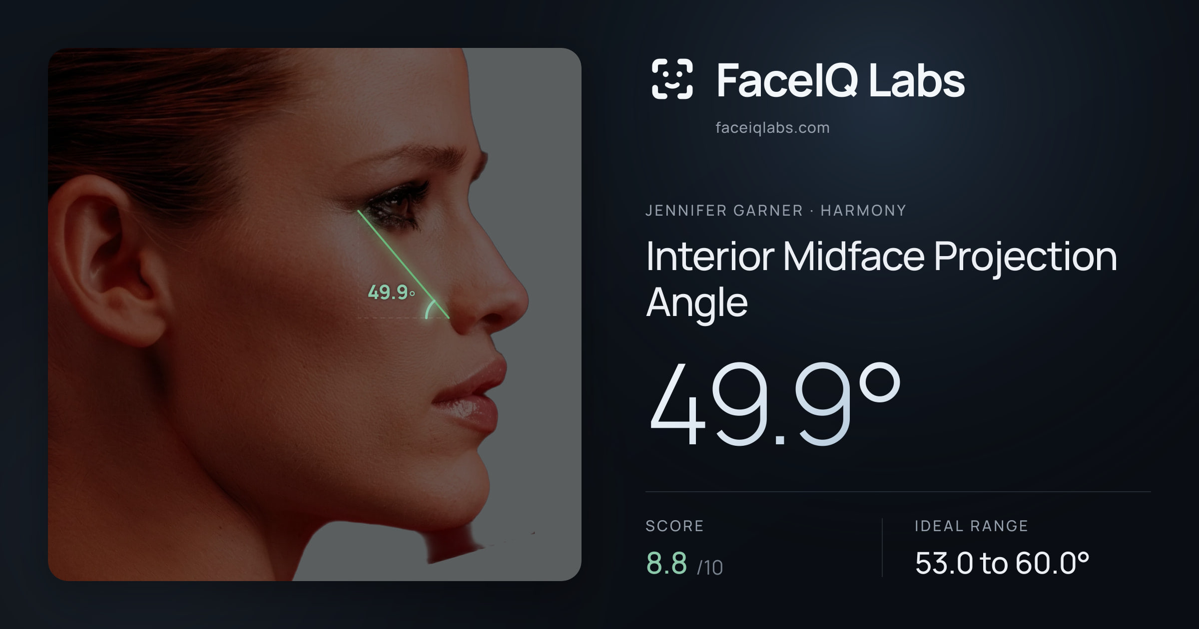 Jennifer Garner Interior Midface Projection Angle: 49.9°, drawn on the photo